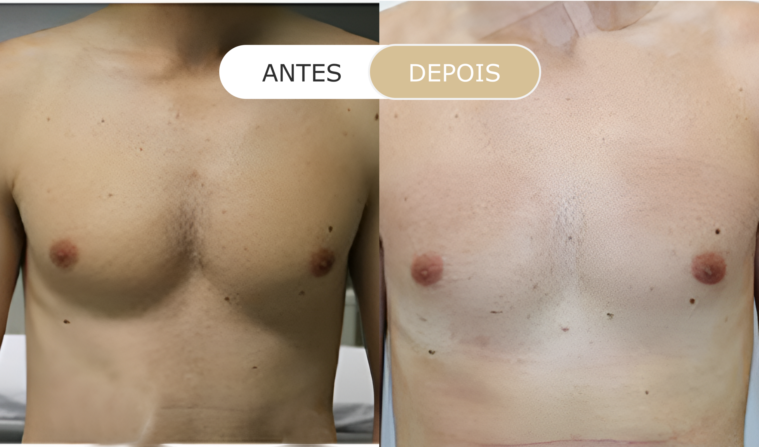 antes e depois - 5