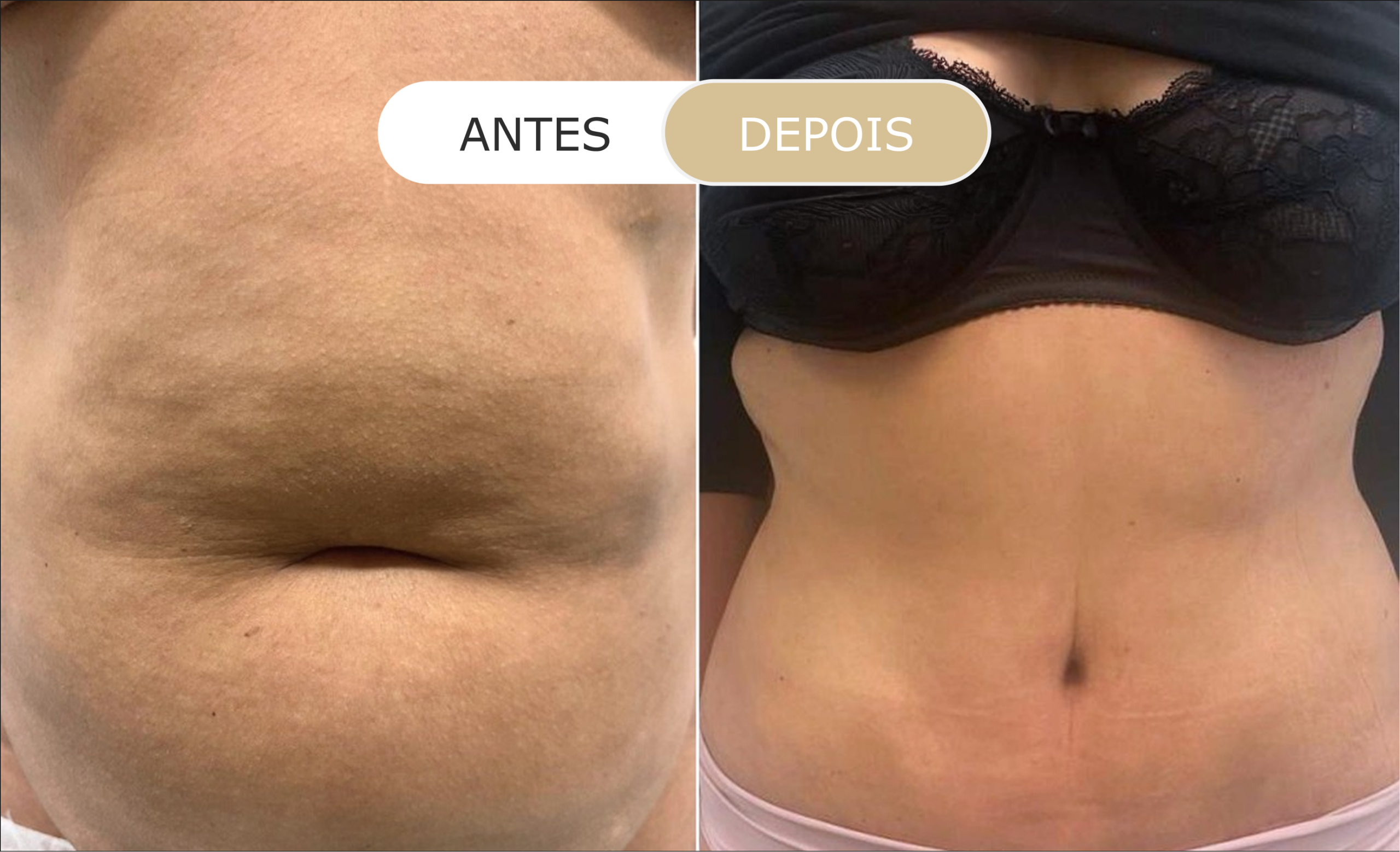 Home 17 antes e depois - 01