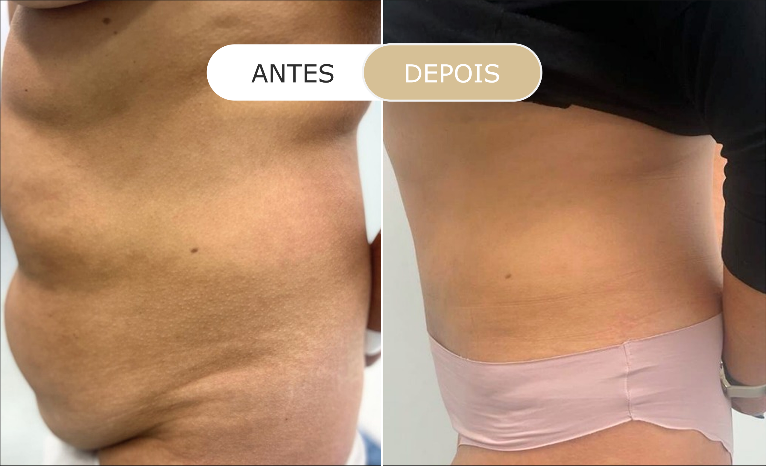 Home 18 antes e depois - 02