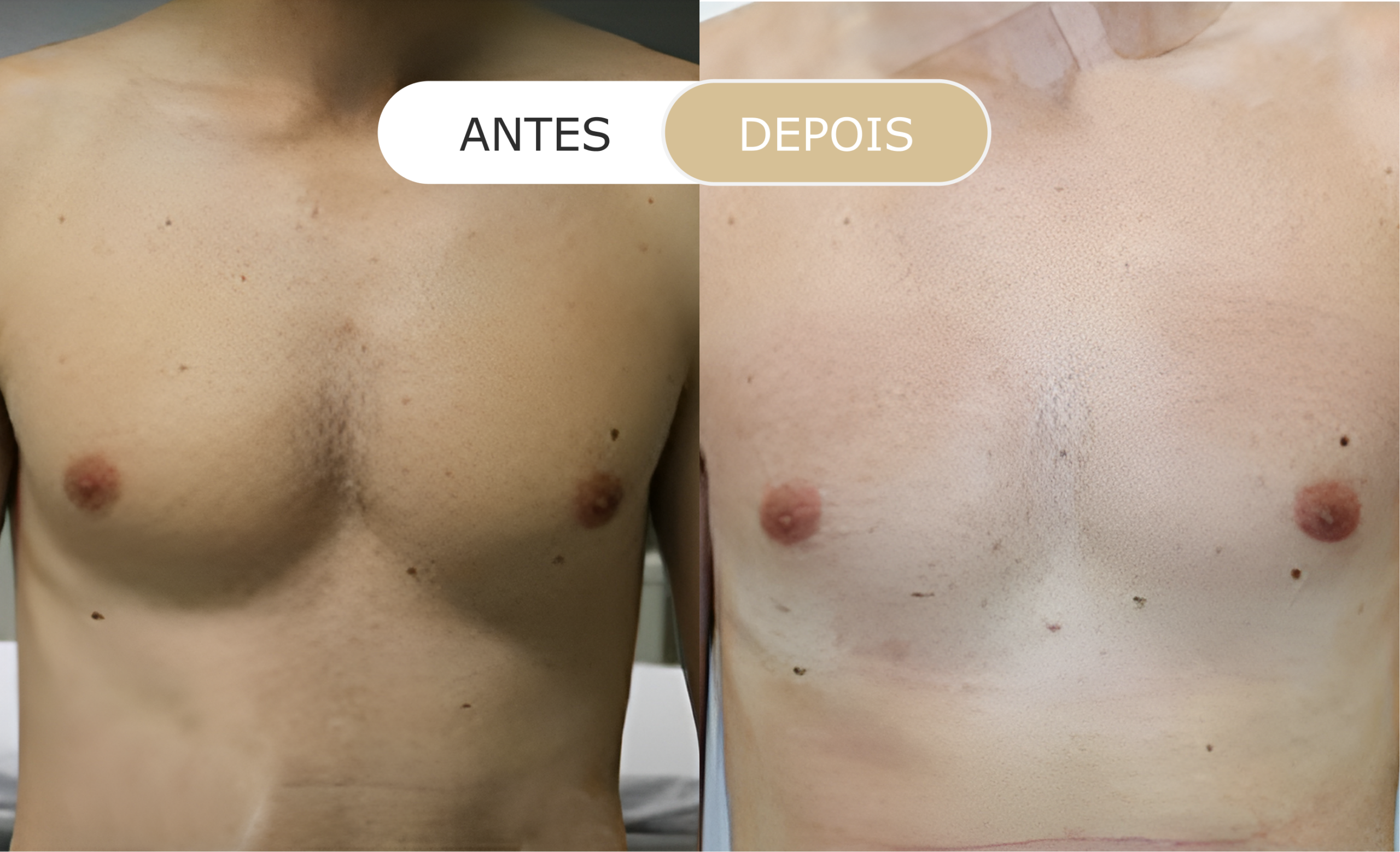 Home 19 antes e depois - 05