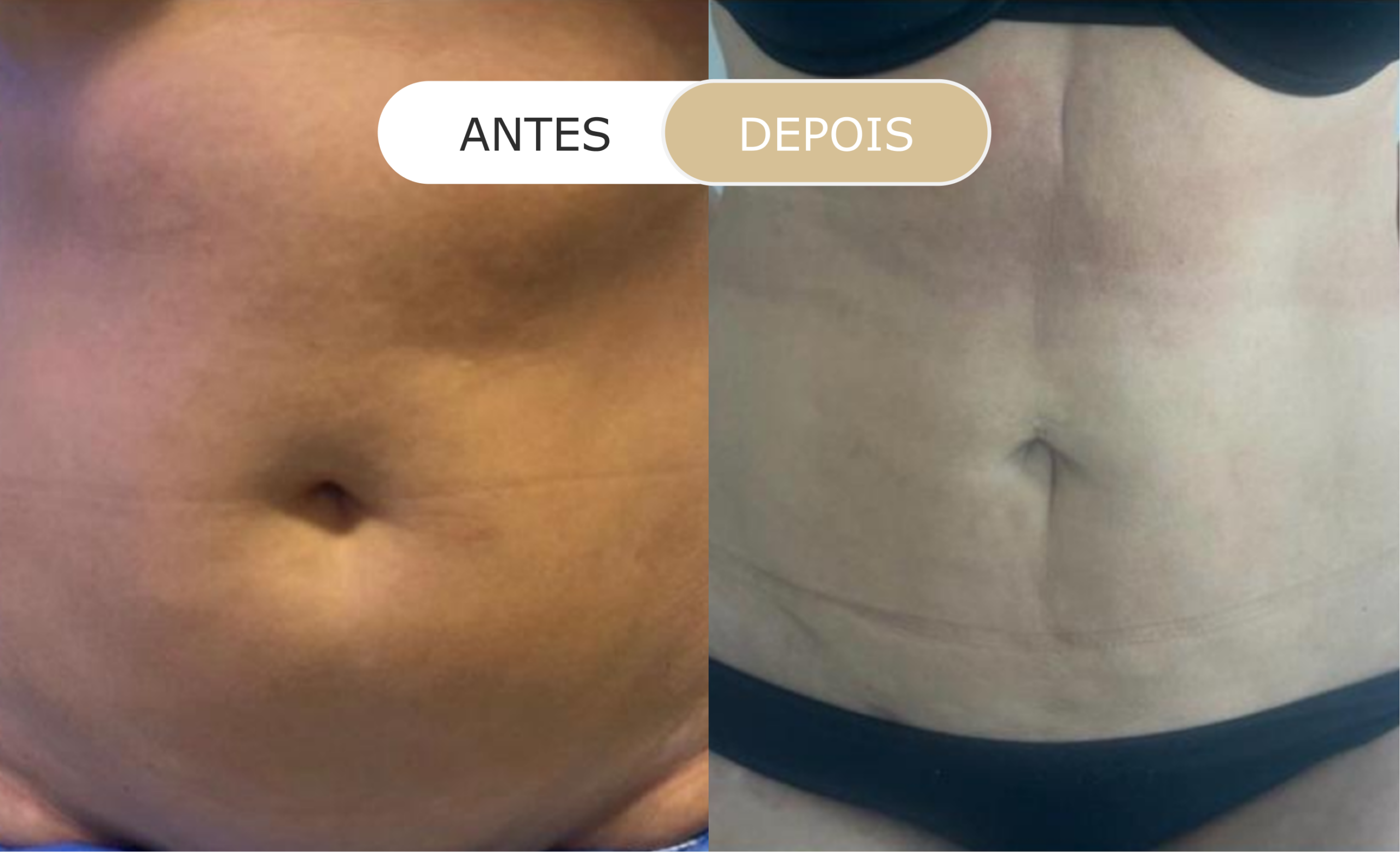 Home 20 antes e depois - 07