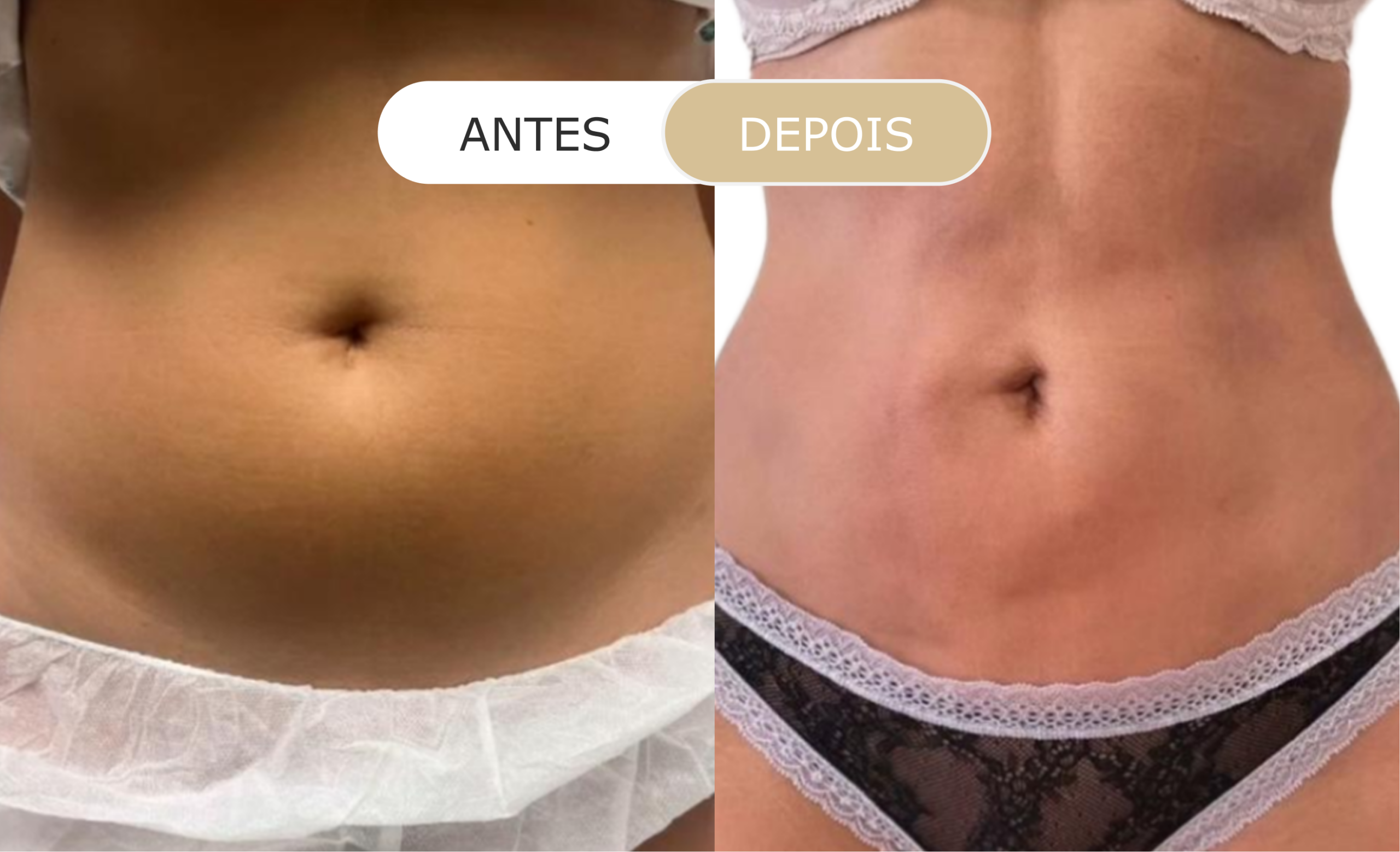 Home 21 antes e depois - 08