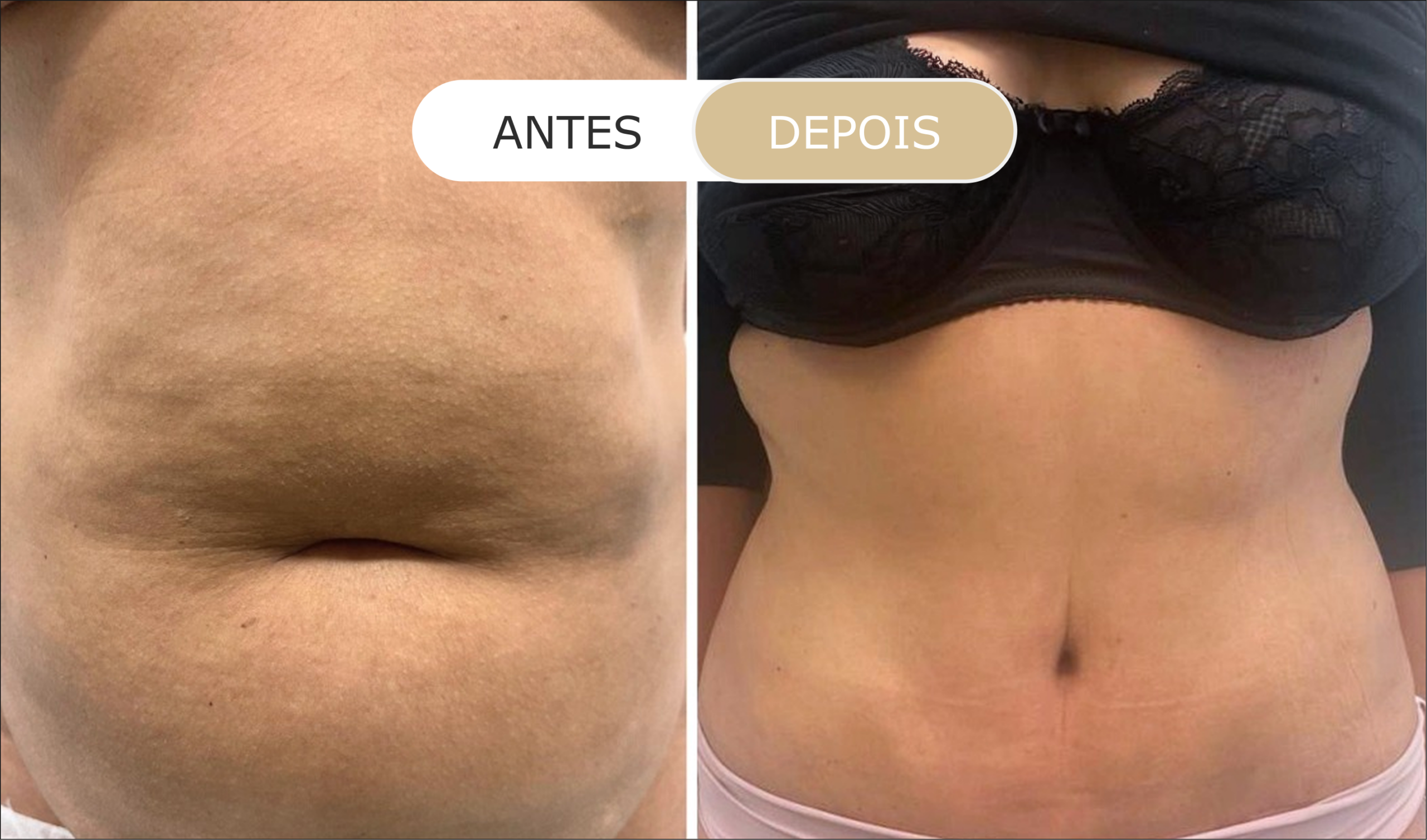 antes e depois - 1