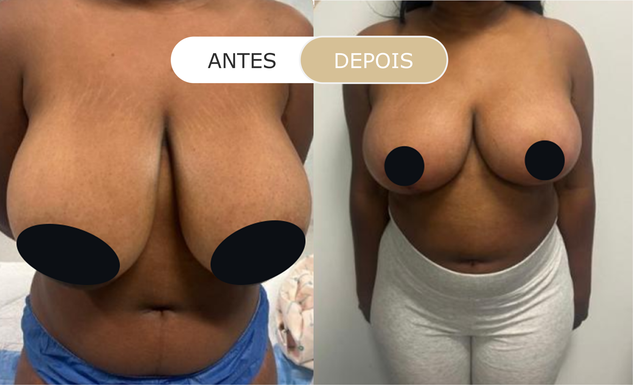 Home 22 antes e depois - 11