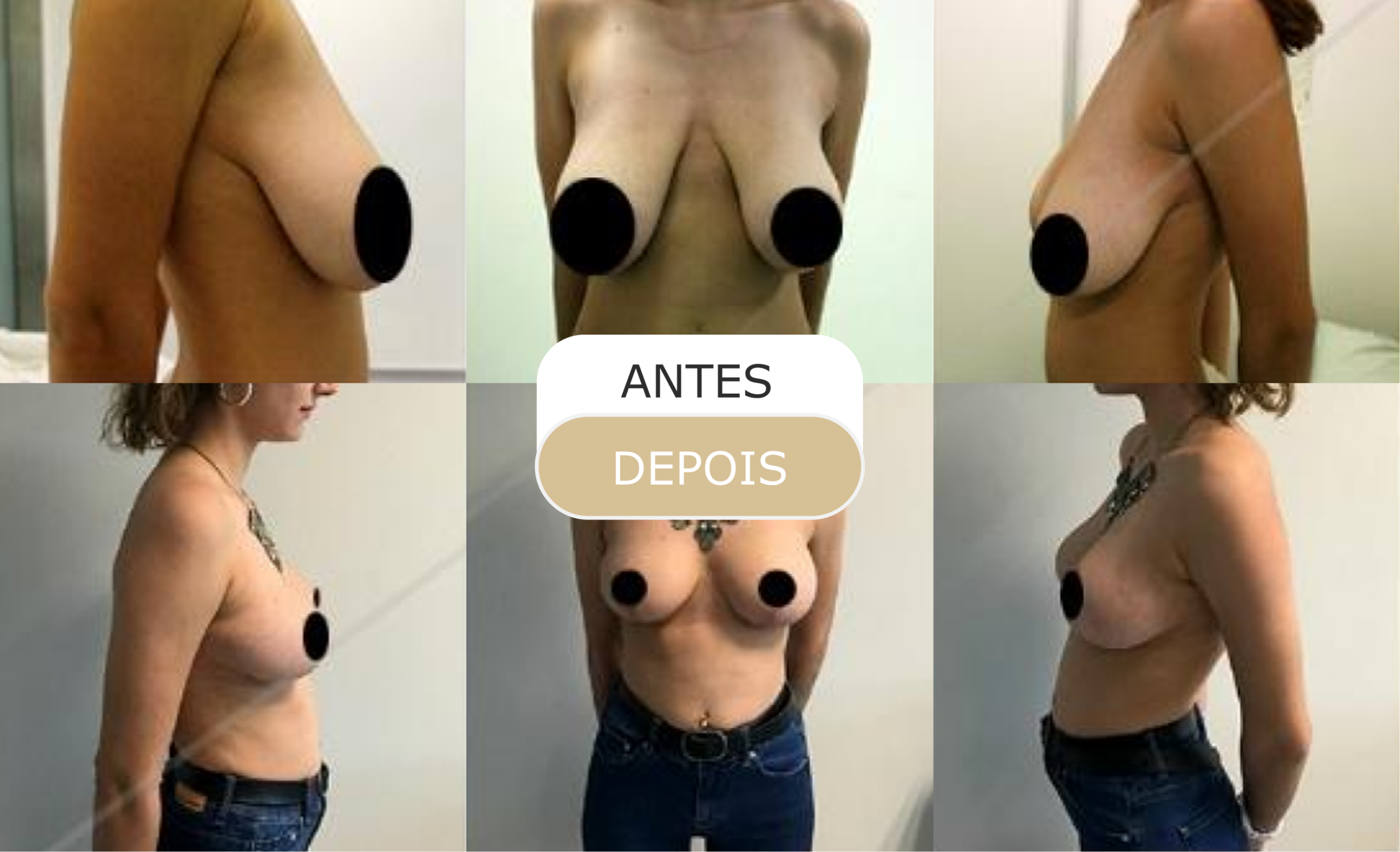 Home 23 antes e depois - 12