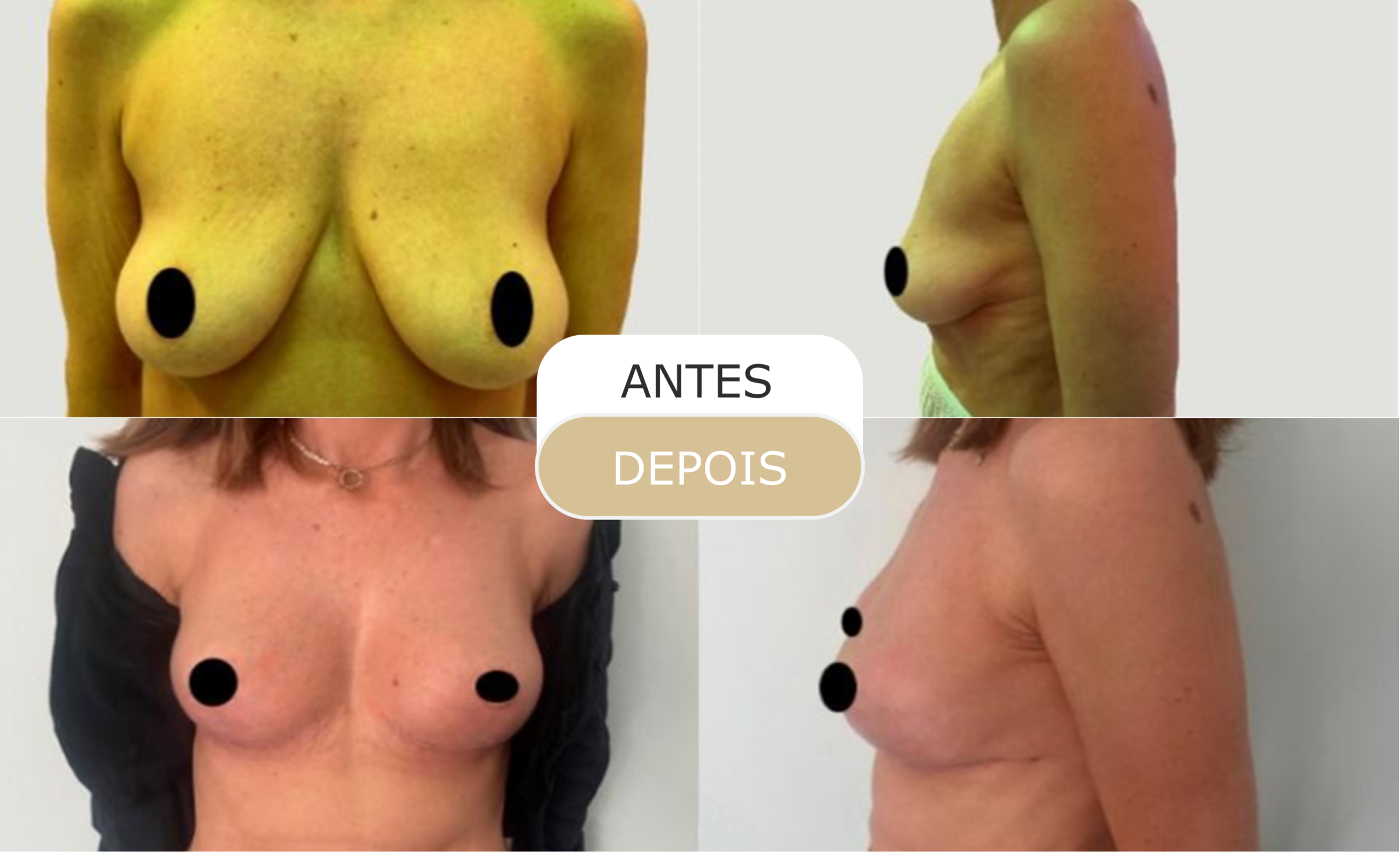 Home 25 antes e depois - 13