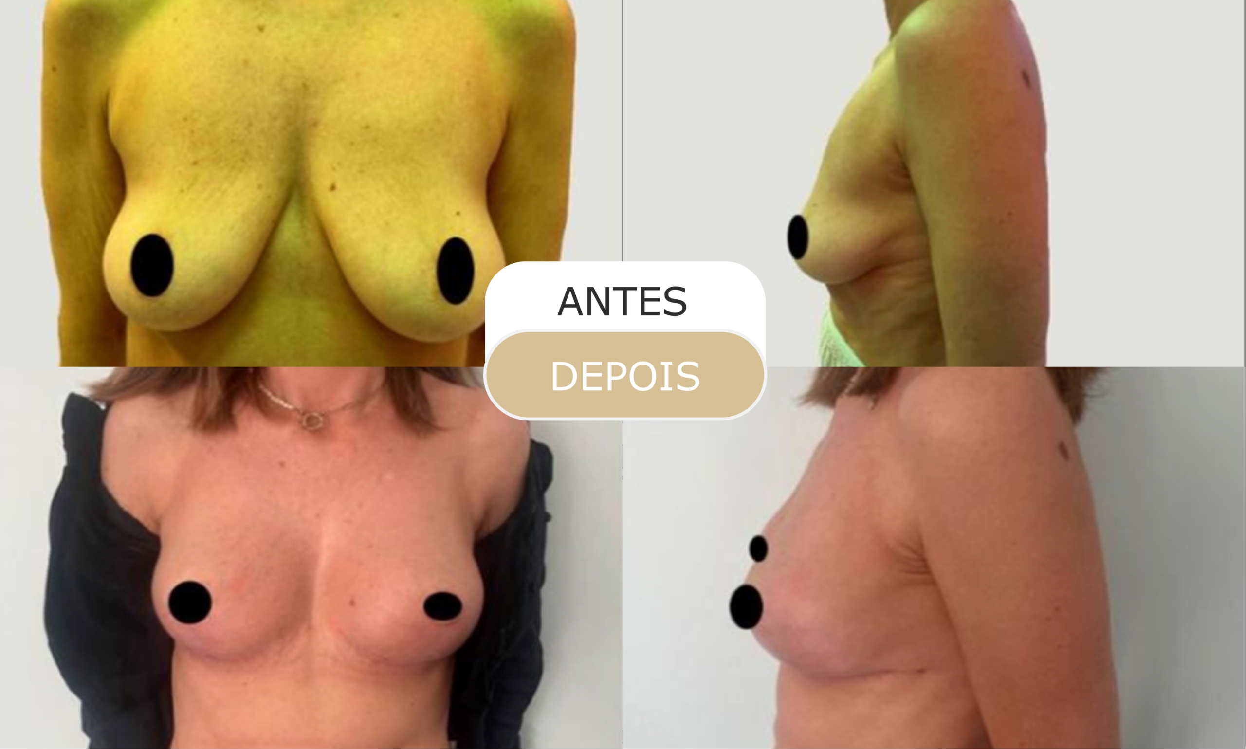 antes e depois - 13