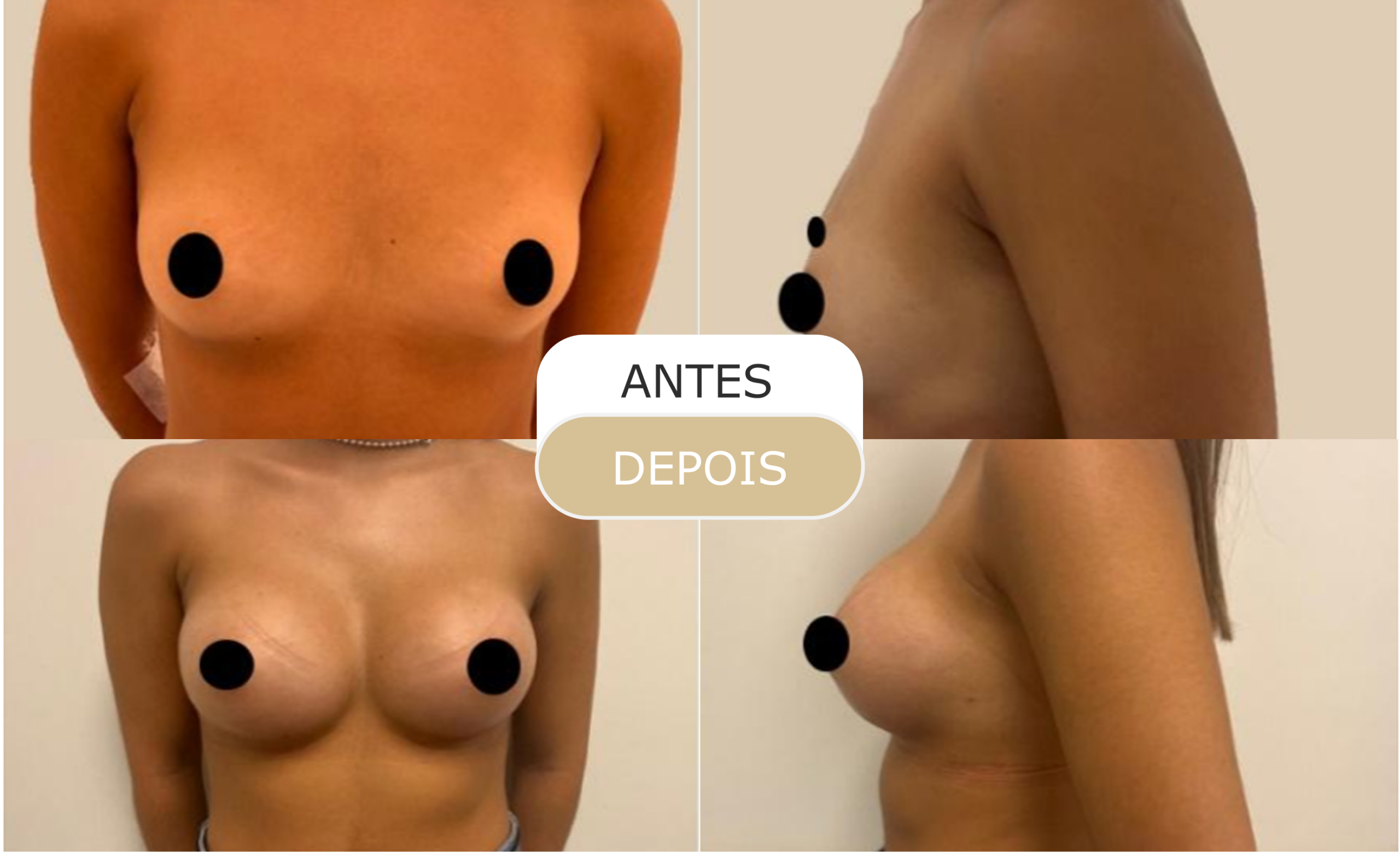 Home 27 antes e depois - 14