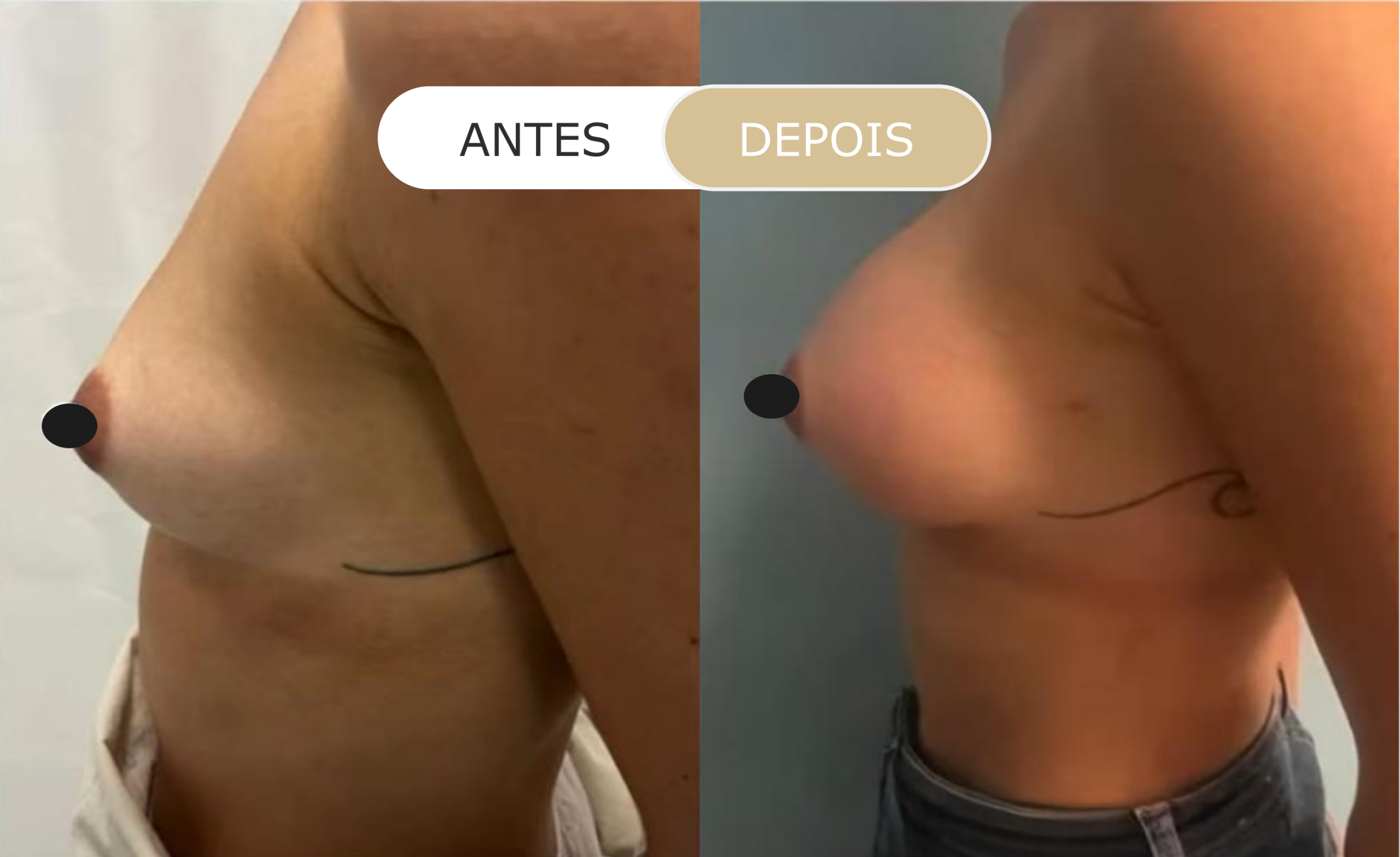 Home 28 antes e depois - 15