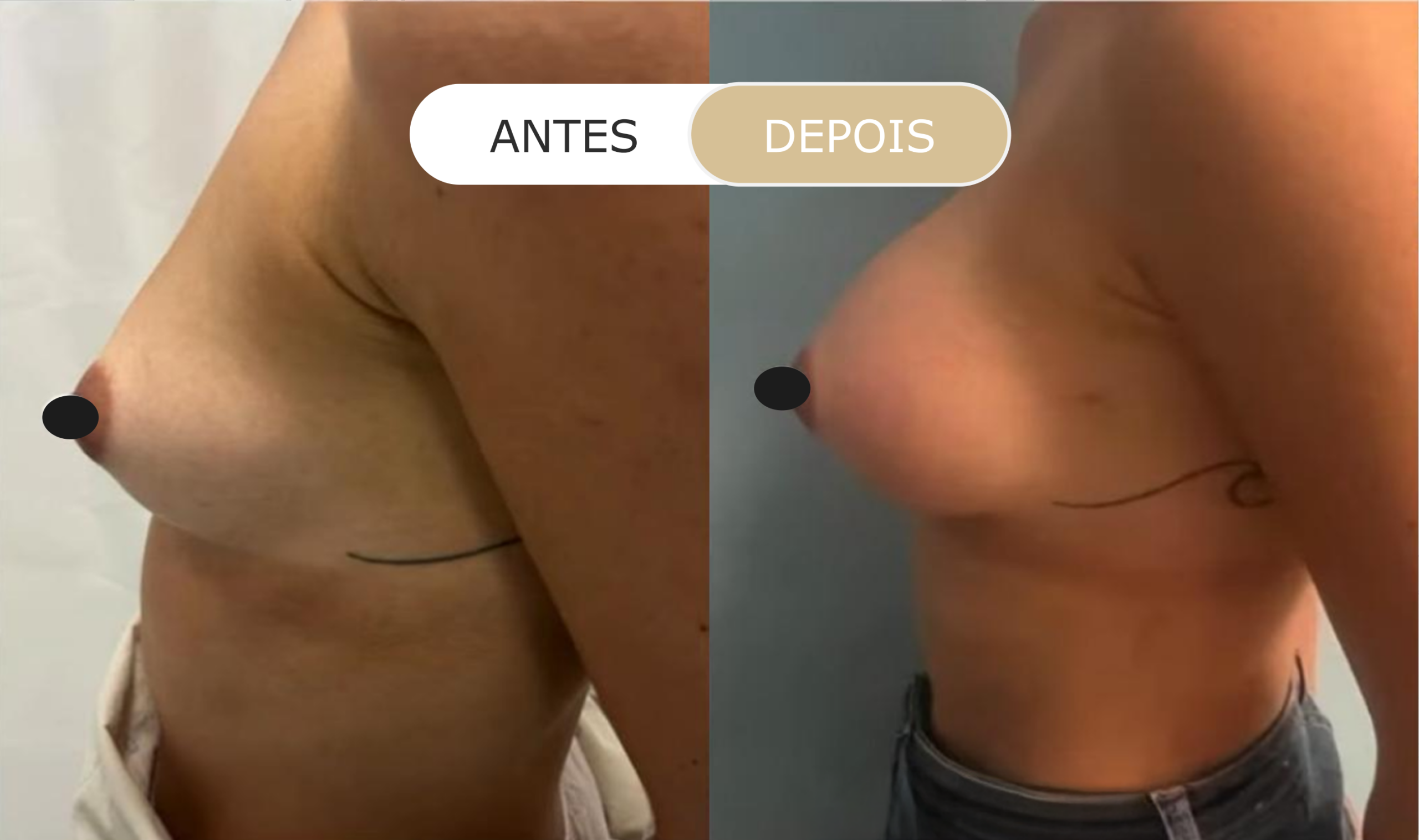 antes e depois - 15
