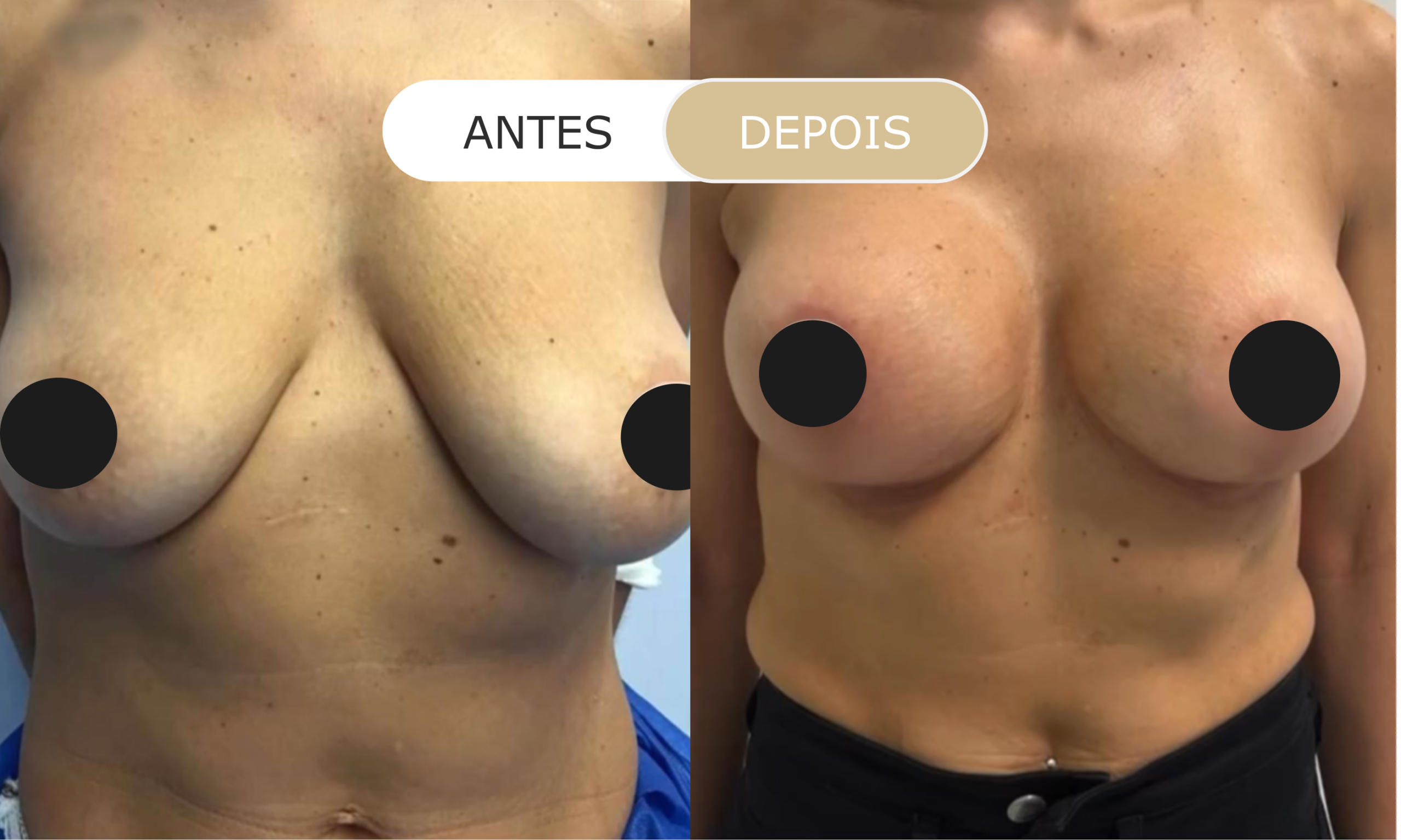 Home 30 antes e depois - 16