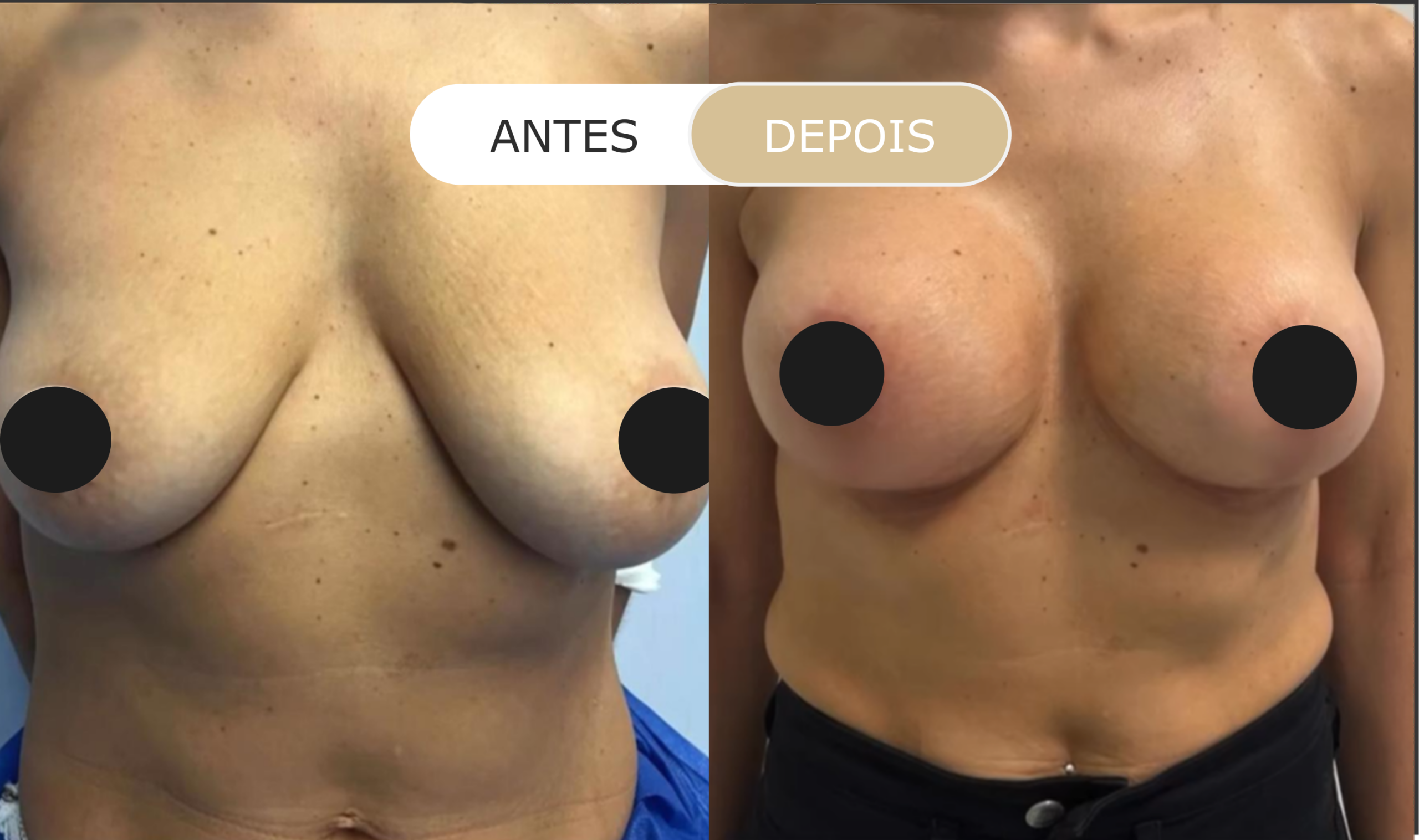 antes e depois - 16