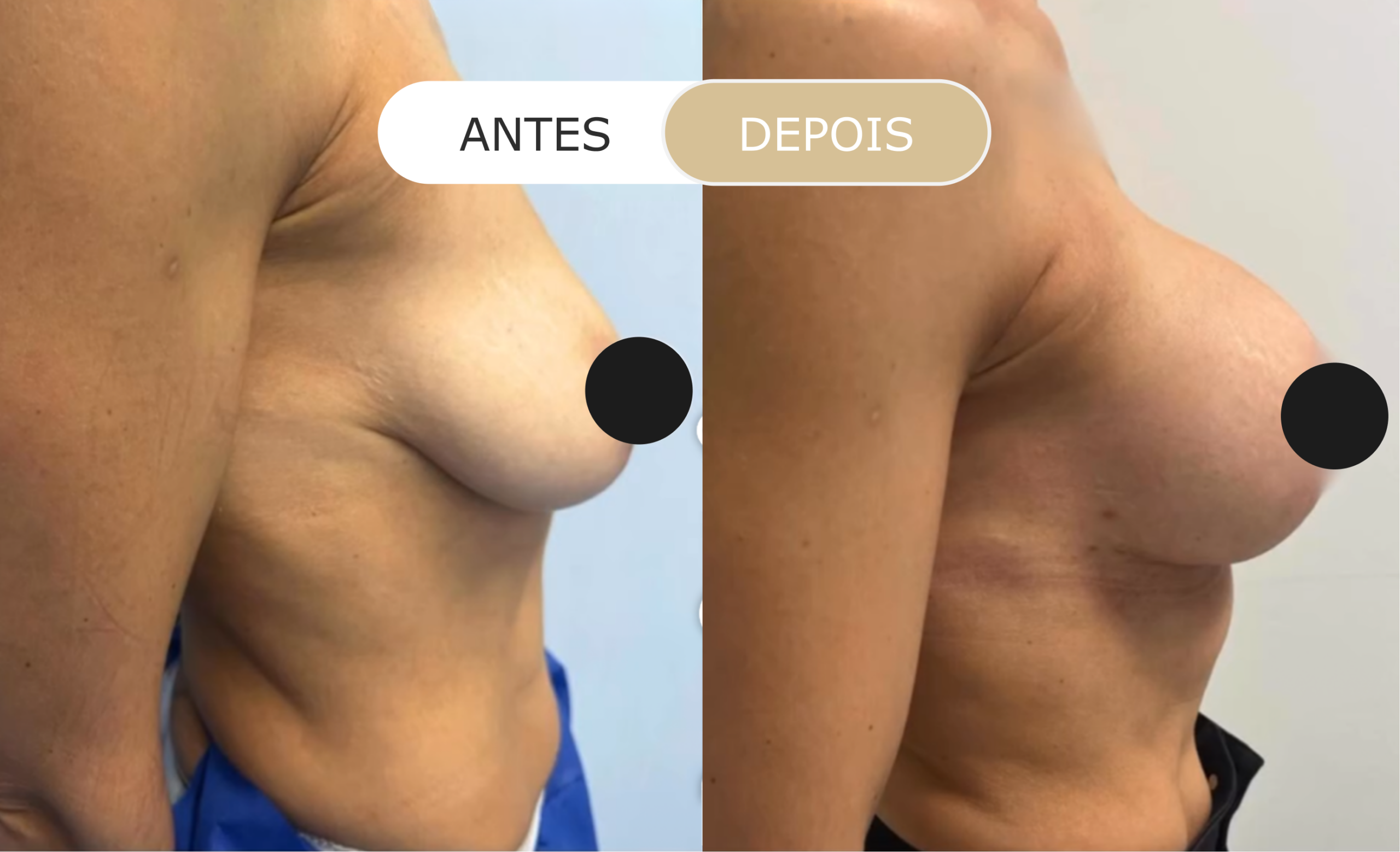 Home 31 antes e depois - 17