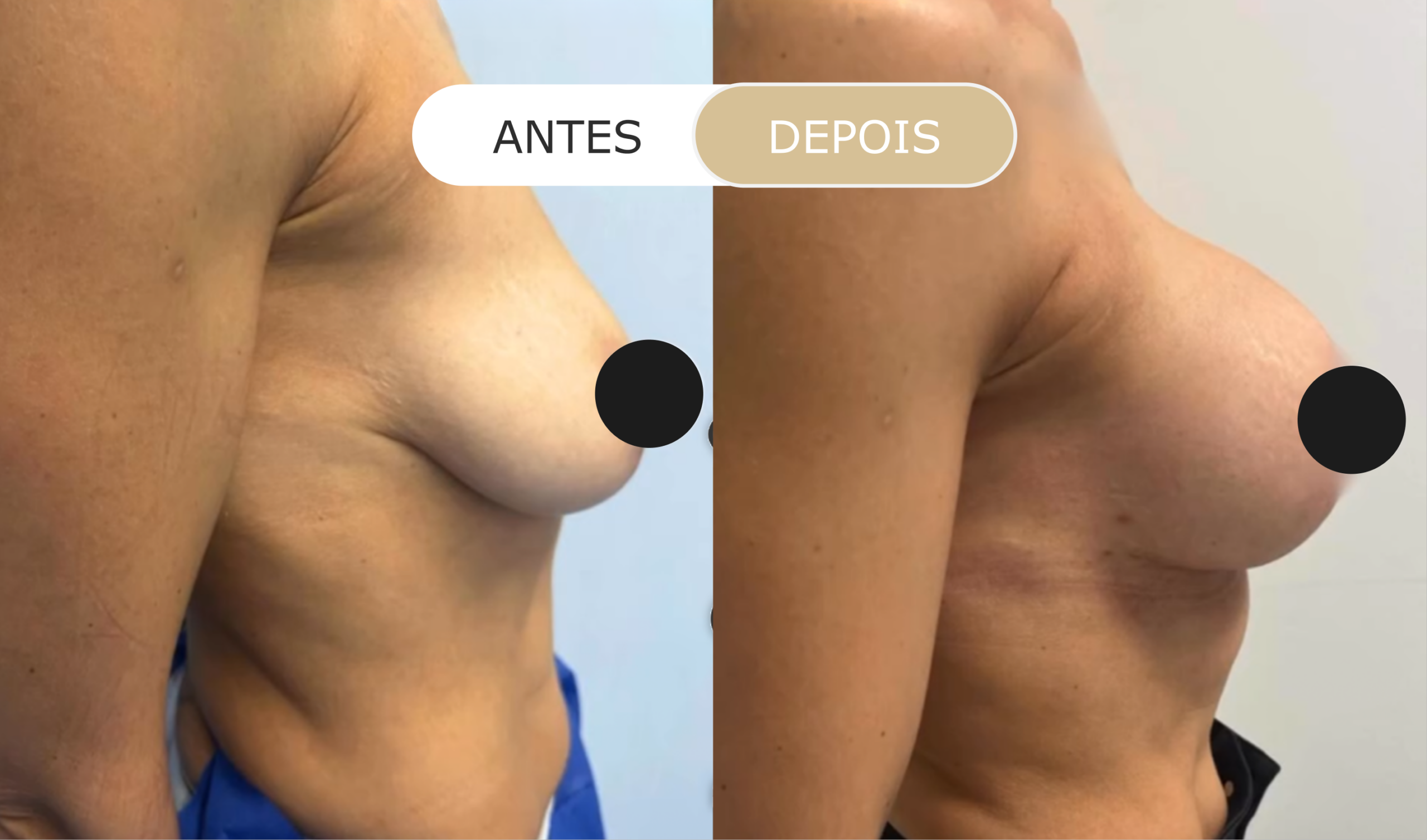 antes e depois - 17