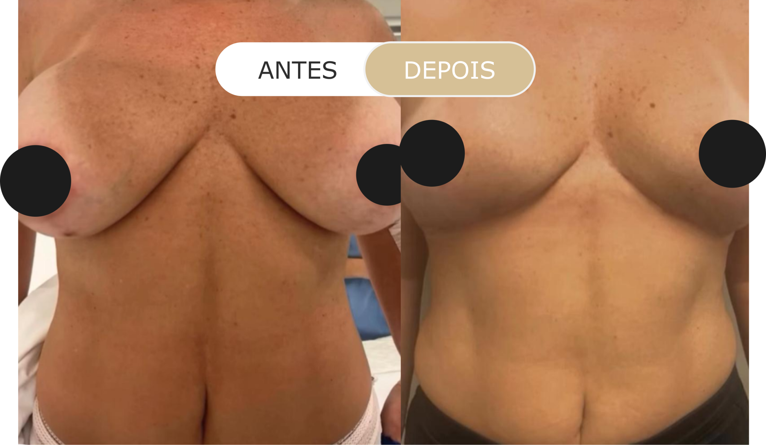 Home 33 antes e depois - 18