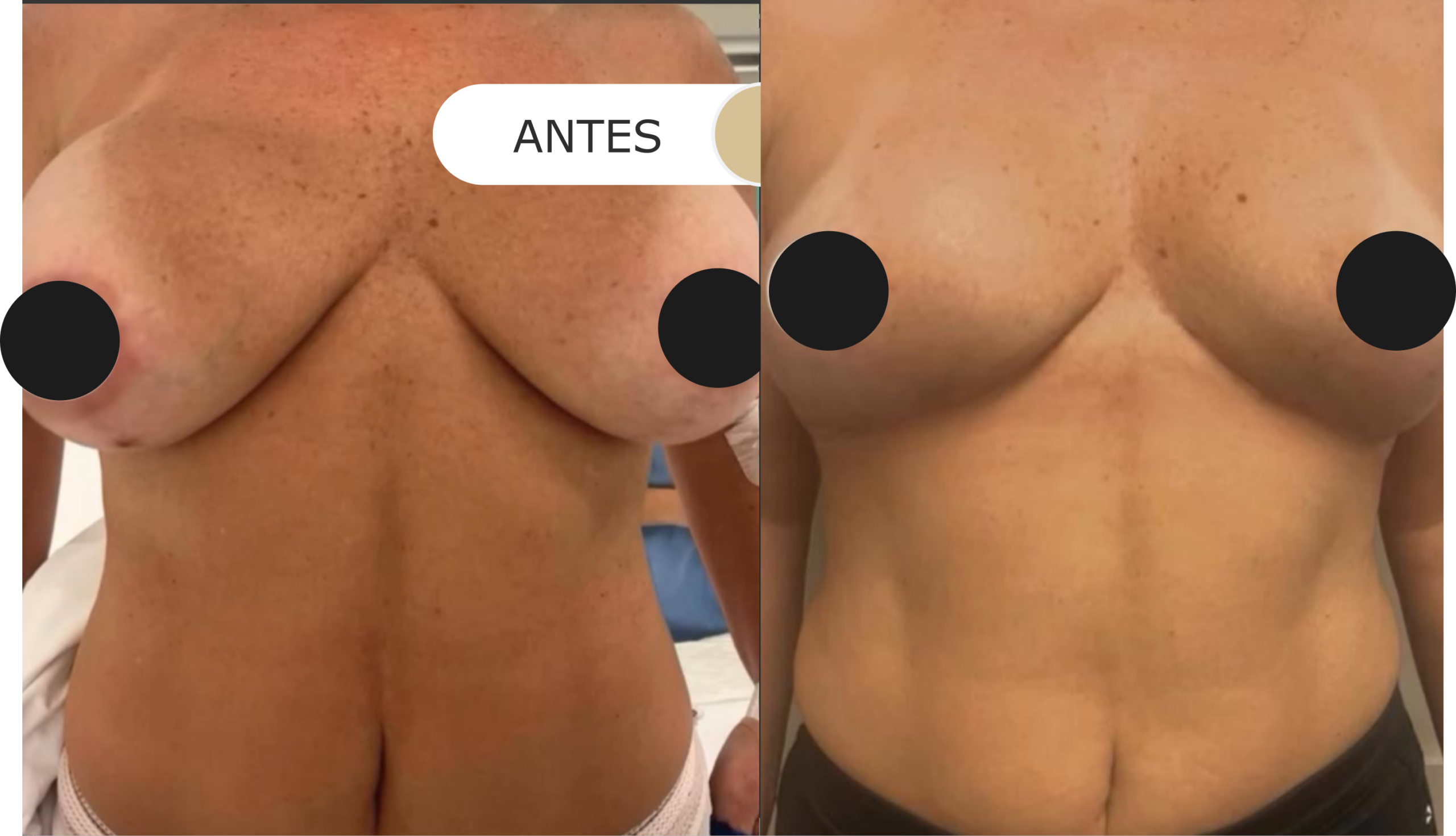 antes e depois - 18