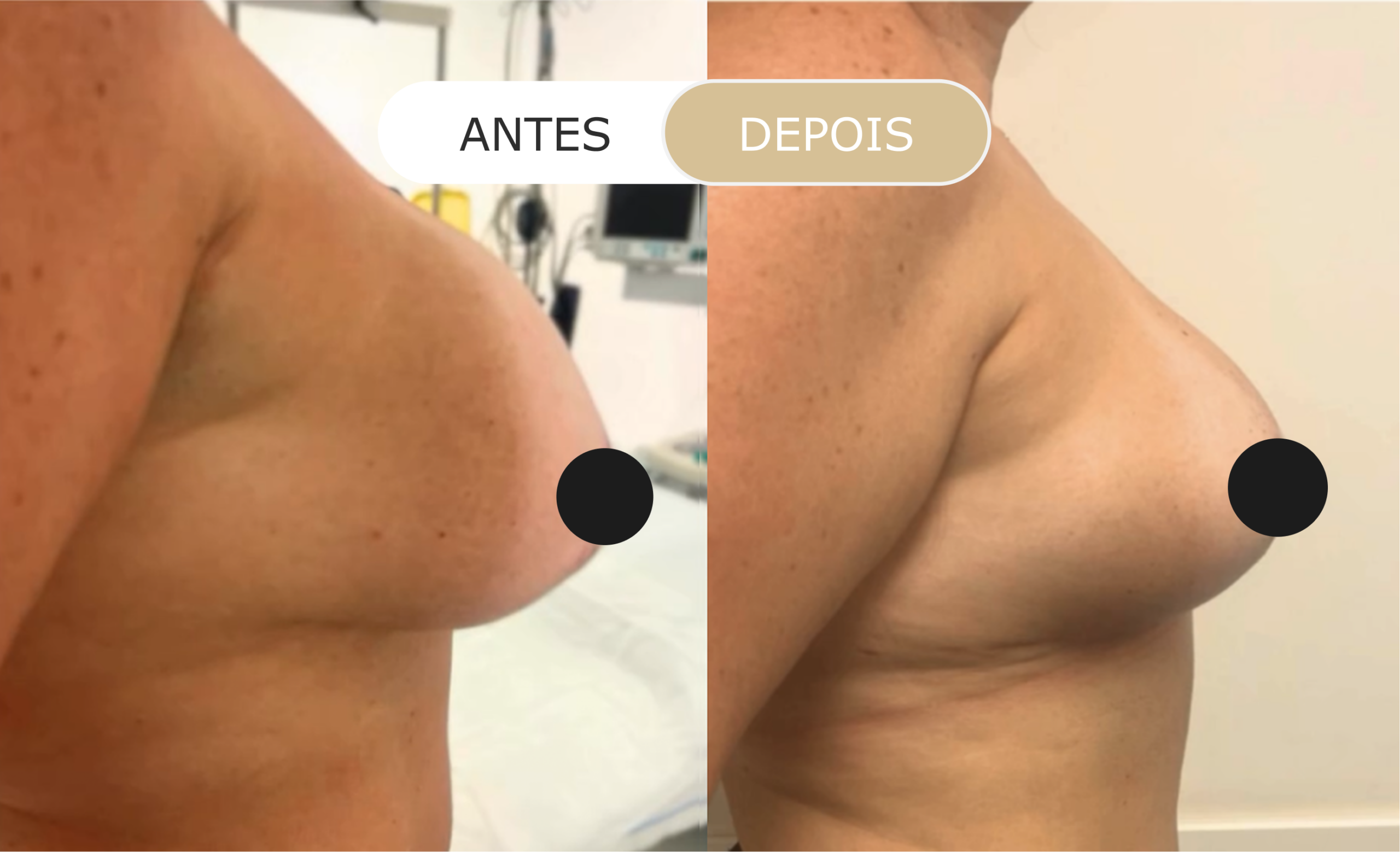 Home 34 antes e depois - 19