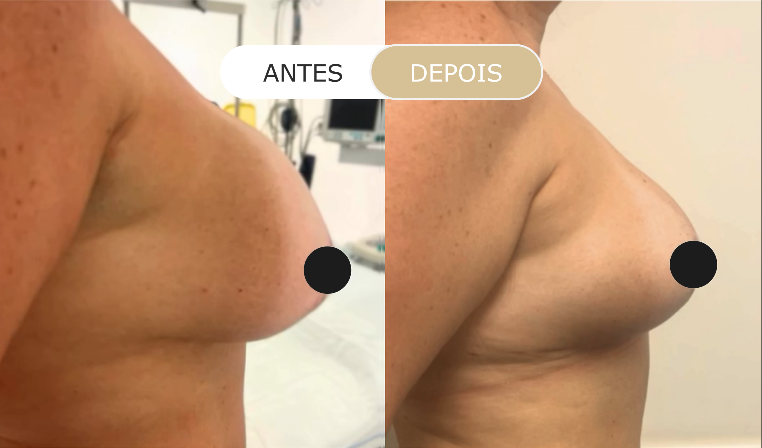 antes e depois - 19
