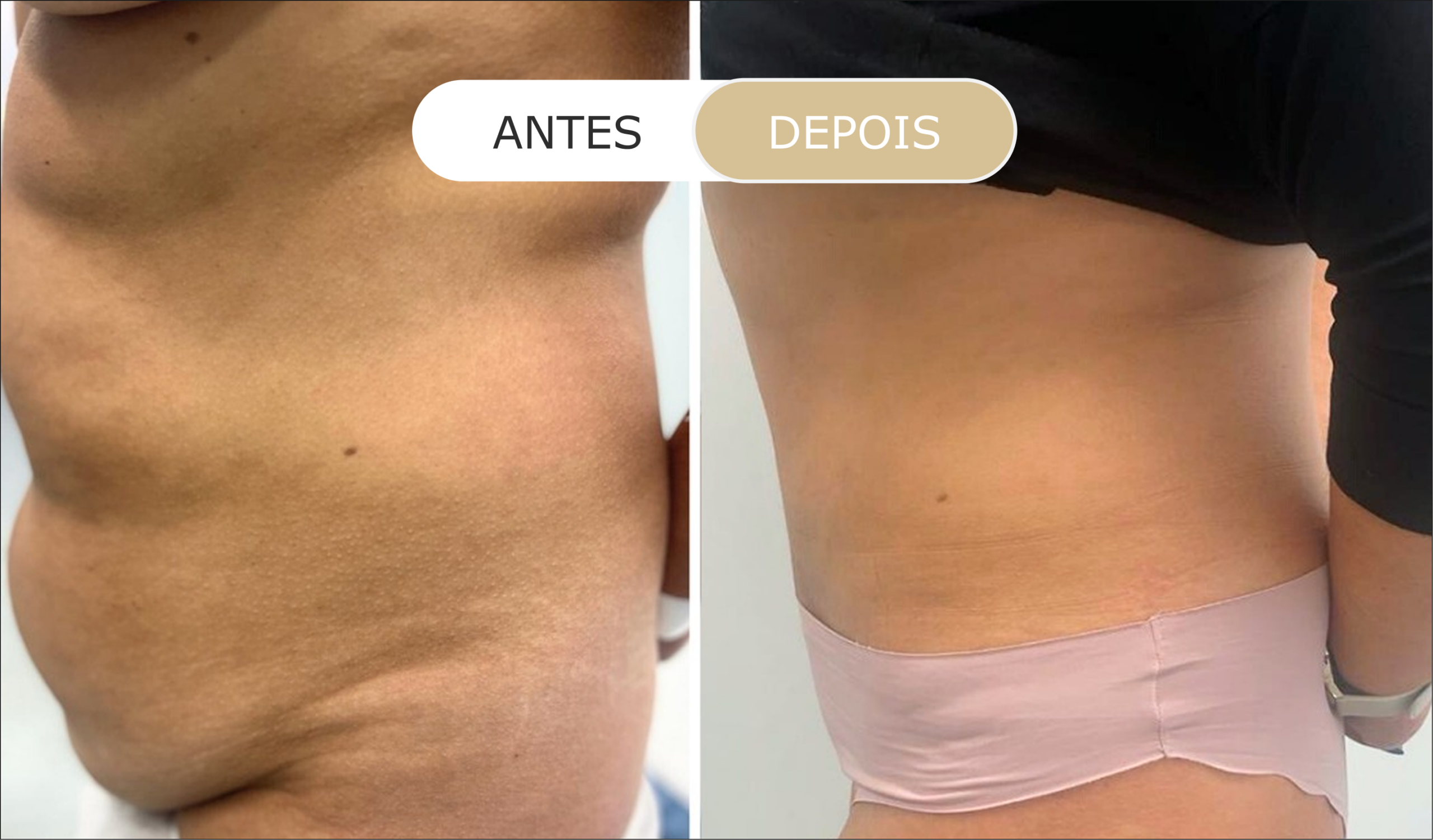 antes e depois - 2