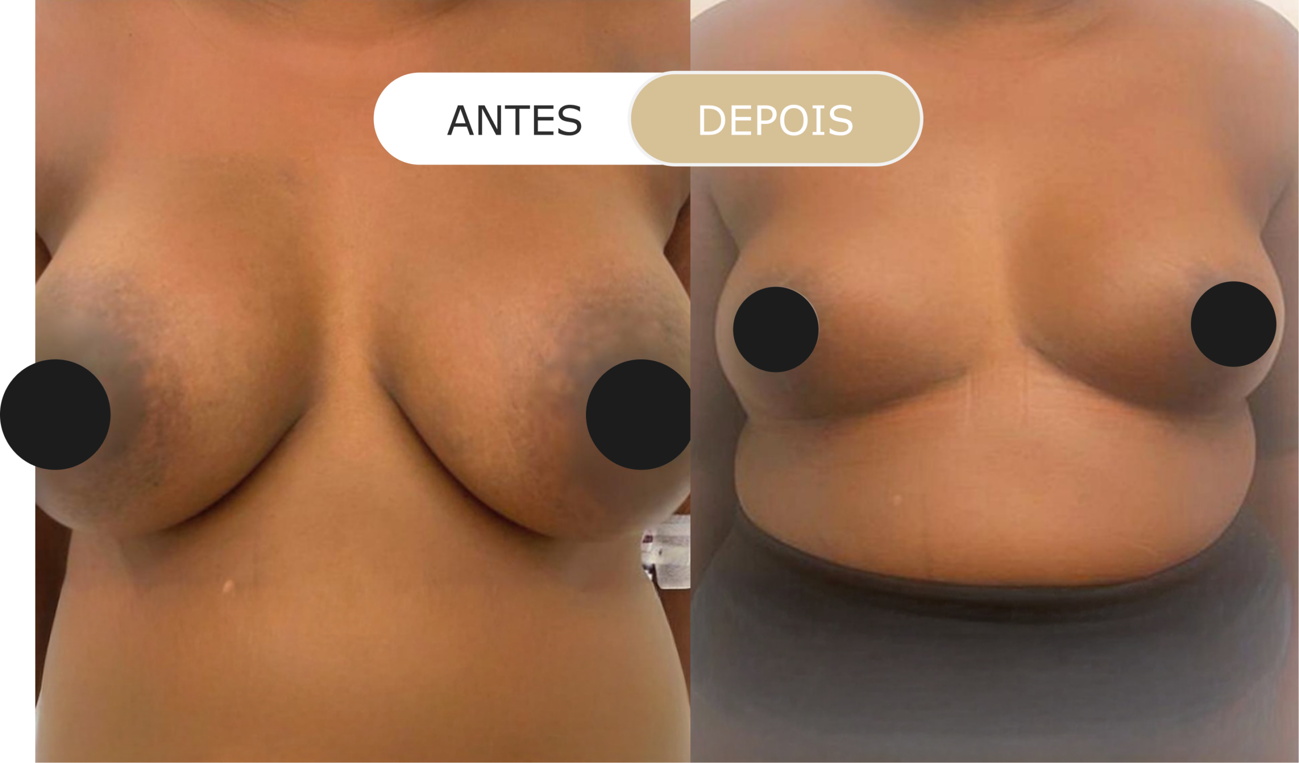 Home 35 antes e depois - 20