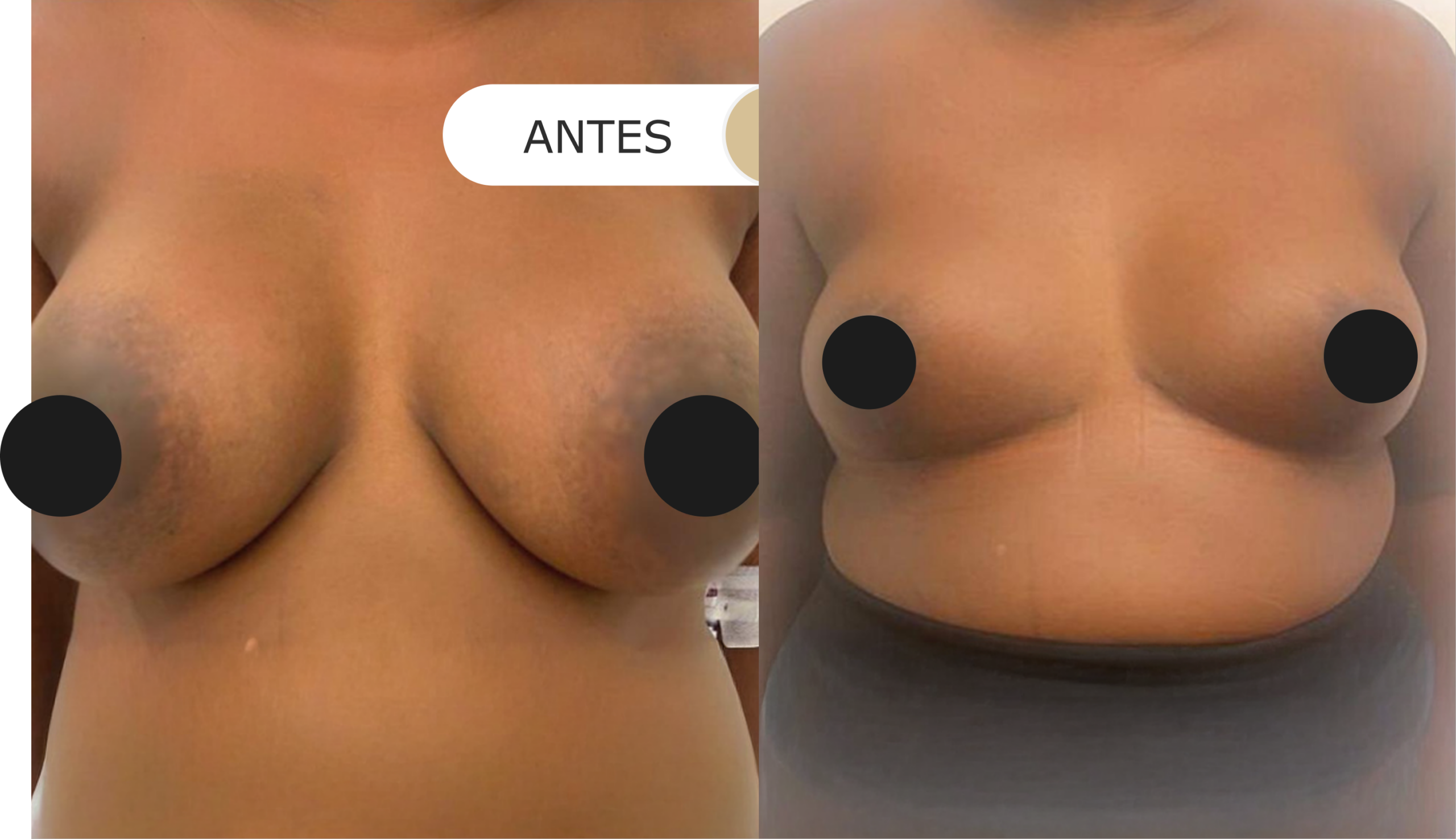 antes e depois - 20