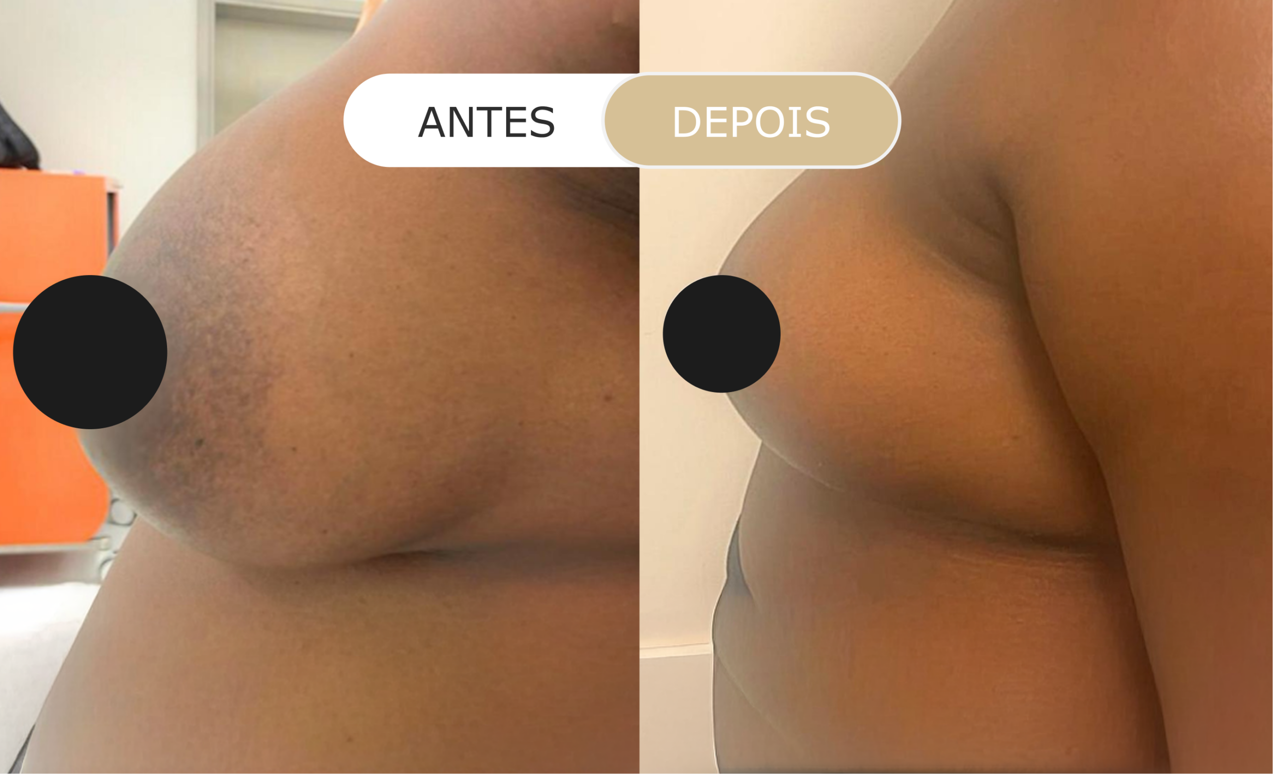 Home 36 antes e depois - 21