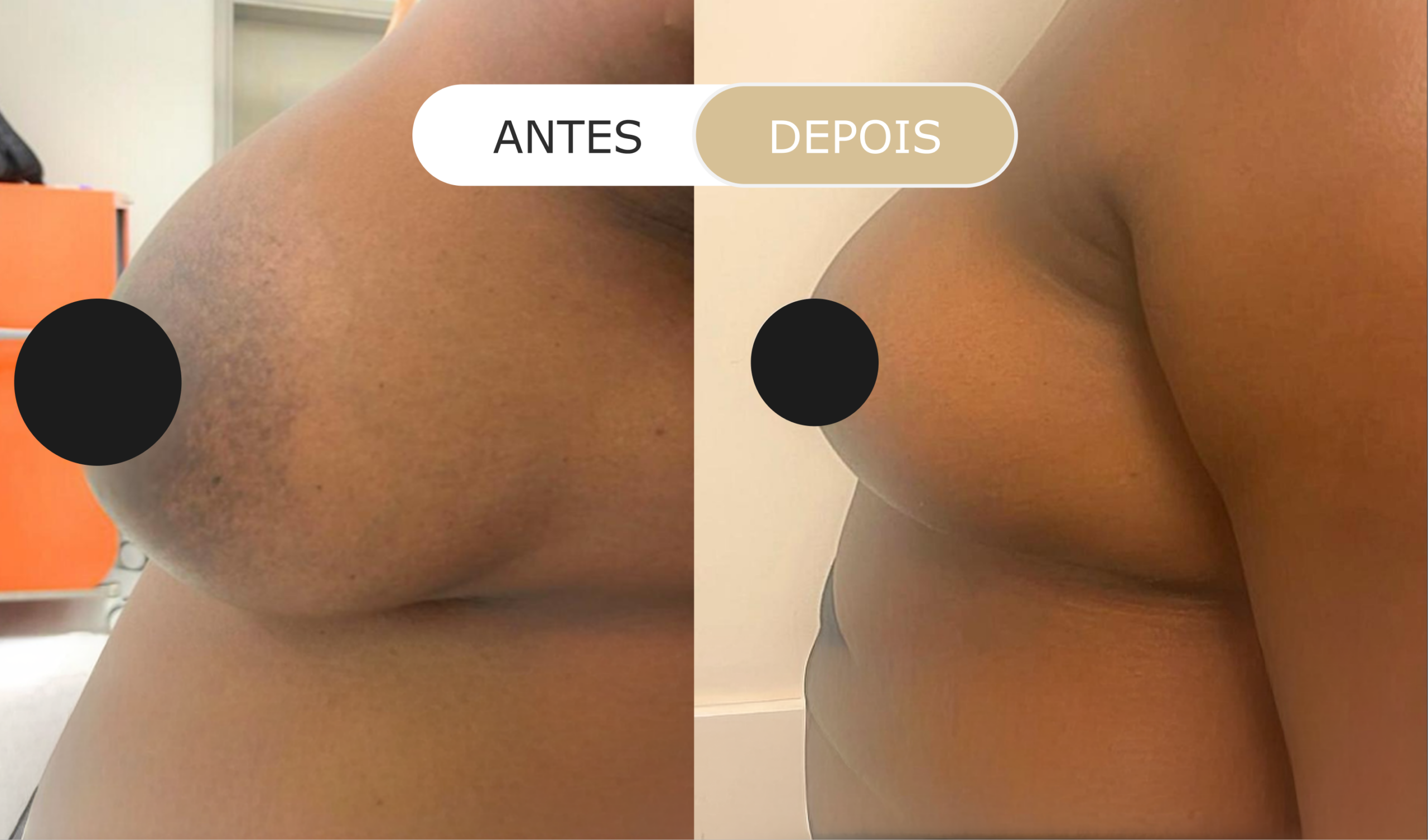 antes e depois - 21