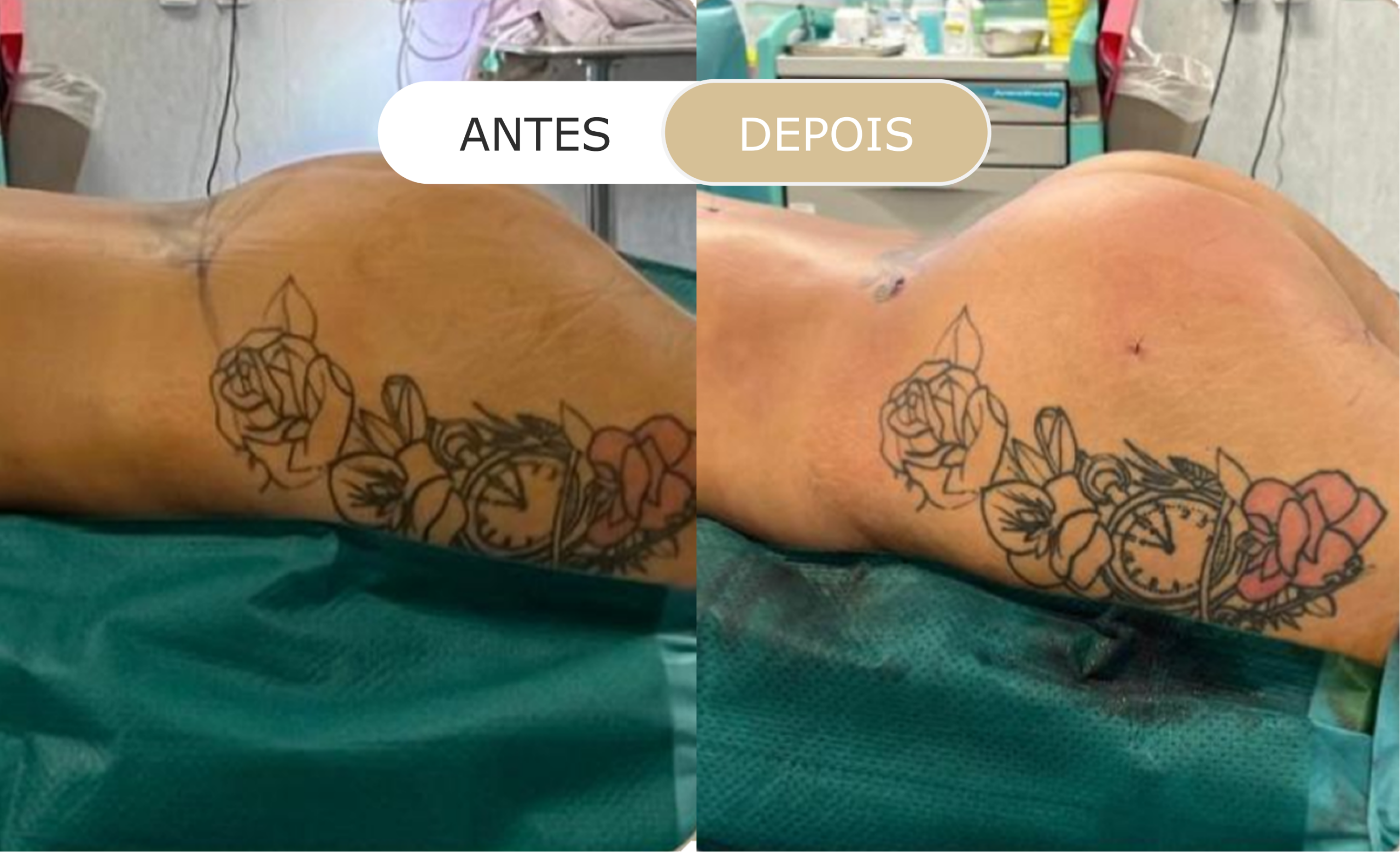 Home 24 antes e depois - 22