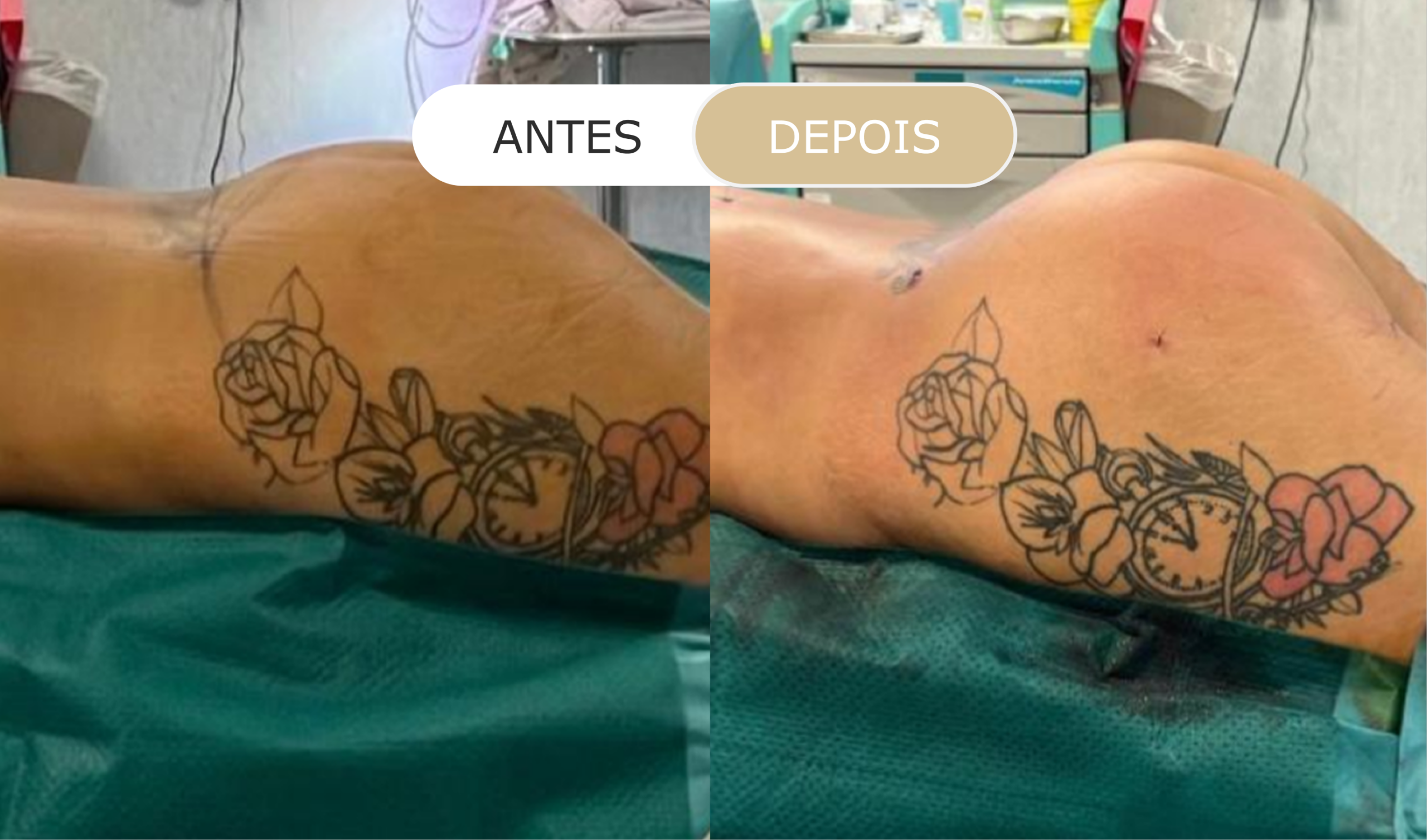 antes e depois - 22