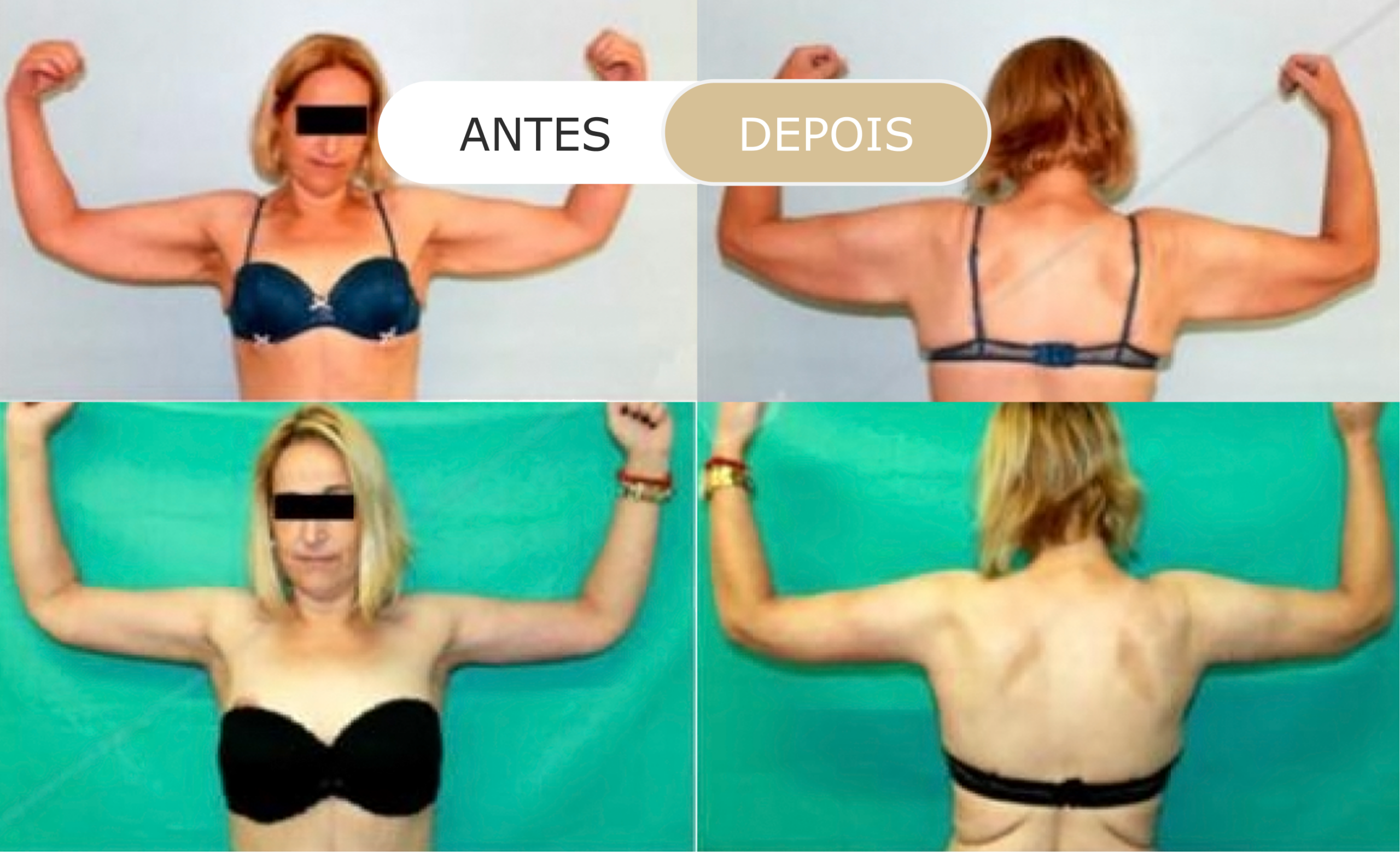 Home 26 antes e depois - 23