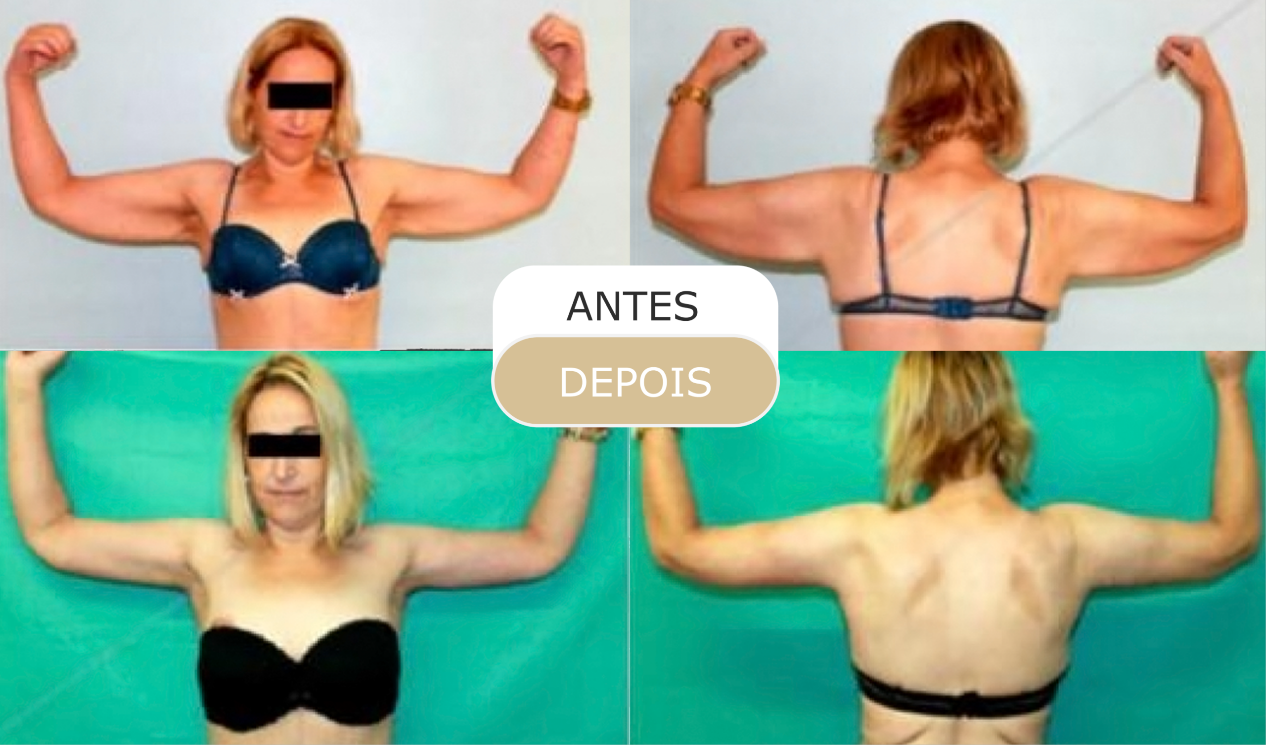 antes e depois - 23