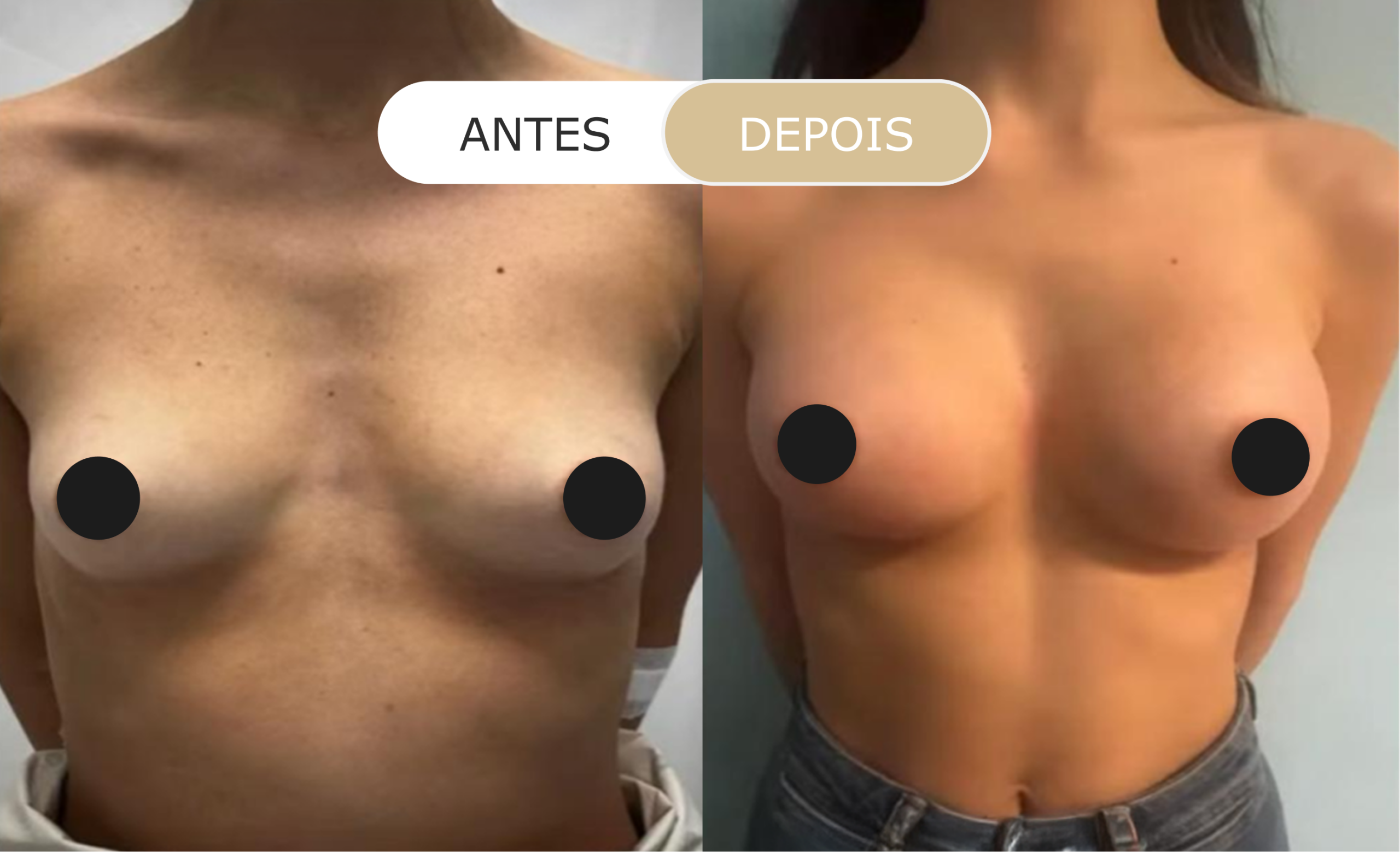 Home 38 antes e depois - 24