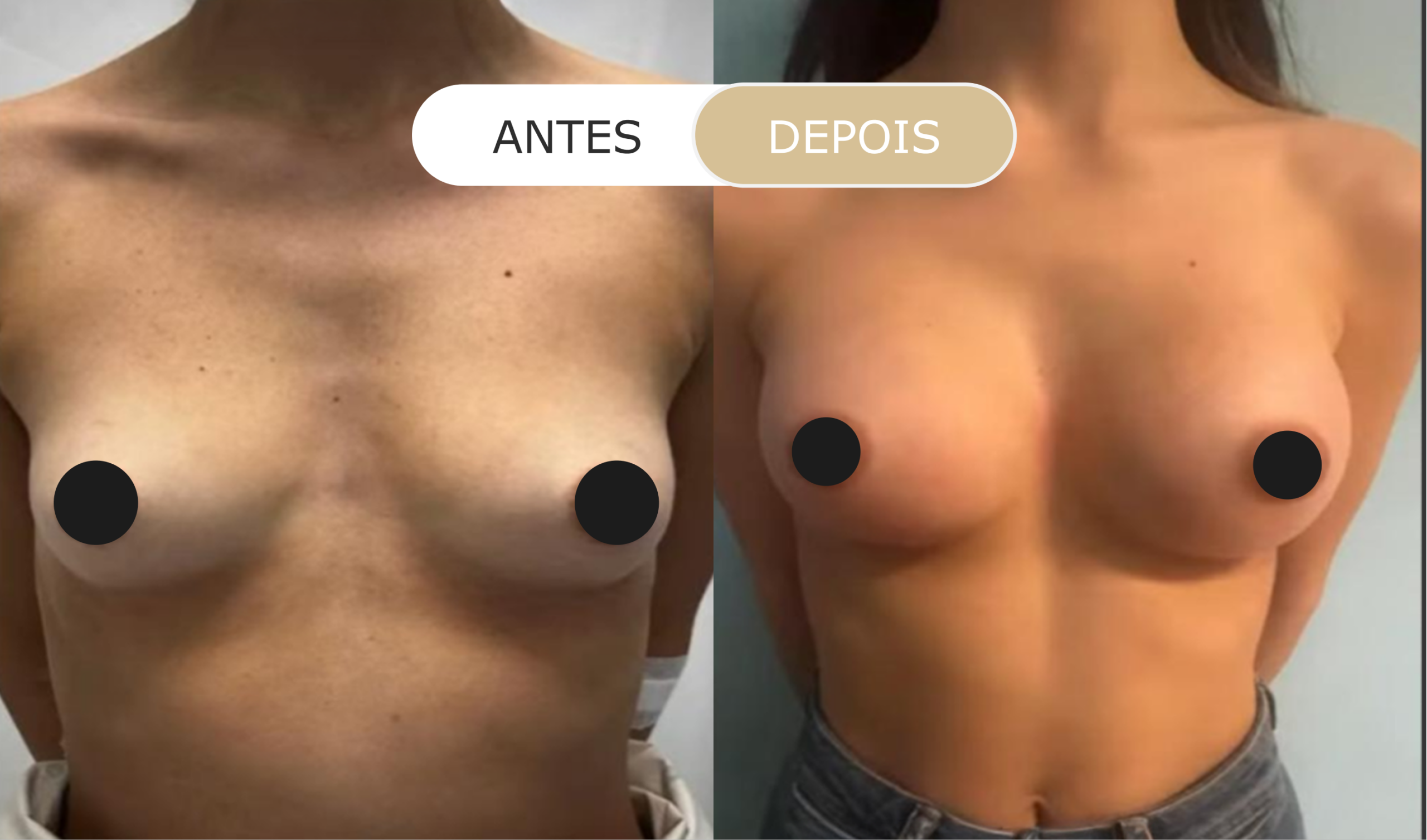 antes e depois - 24