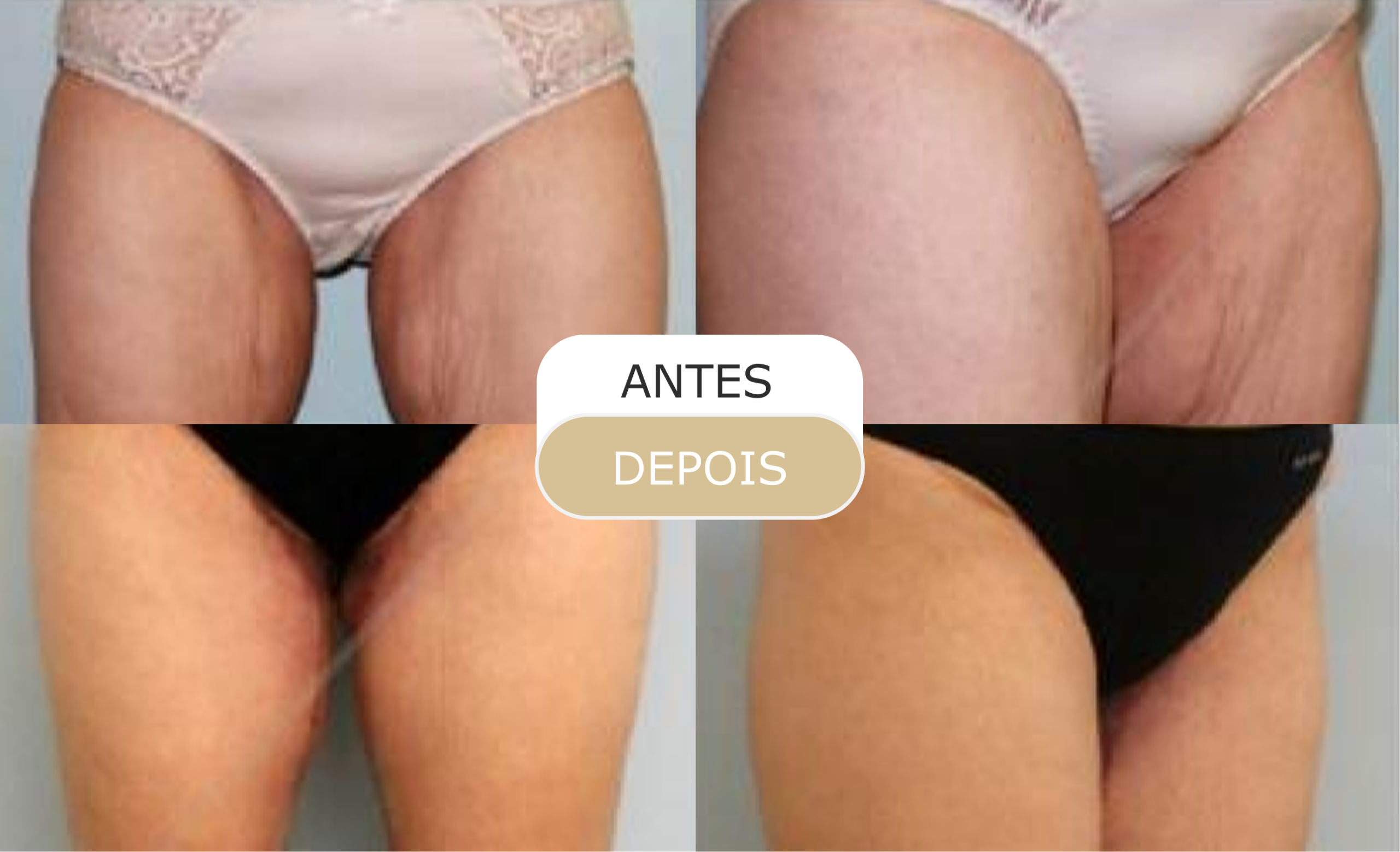 Home 37 antes e depois - 25