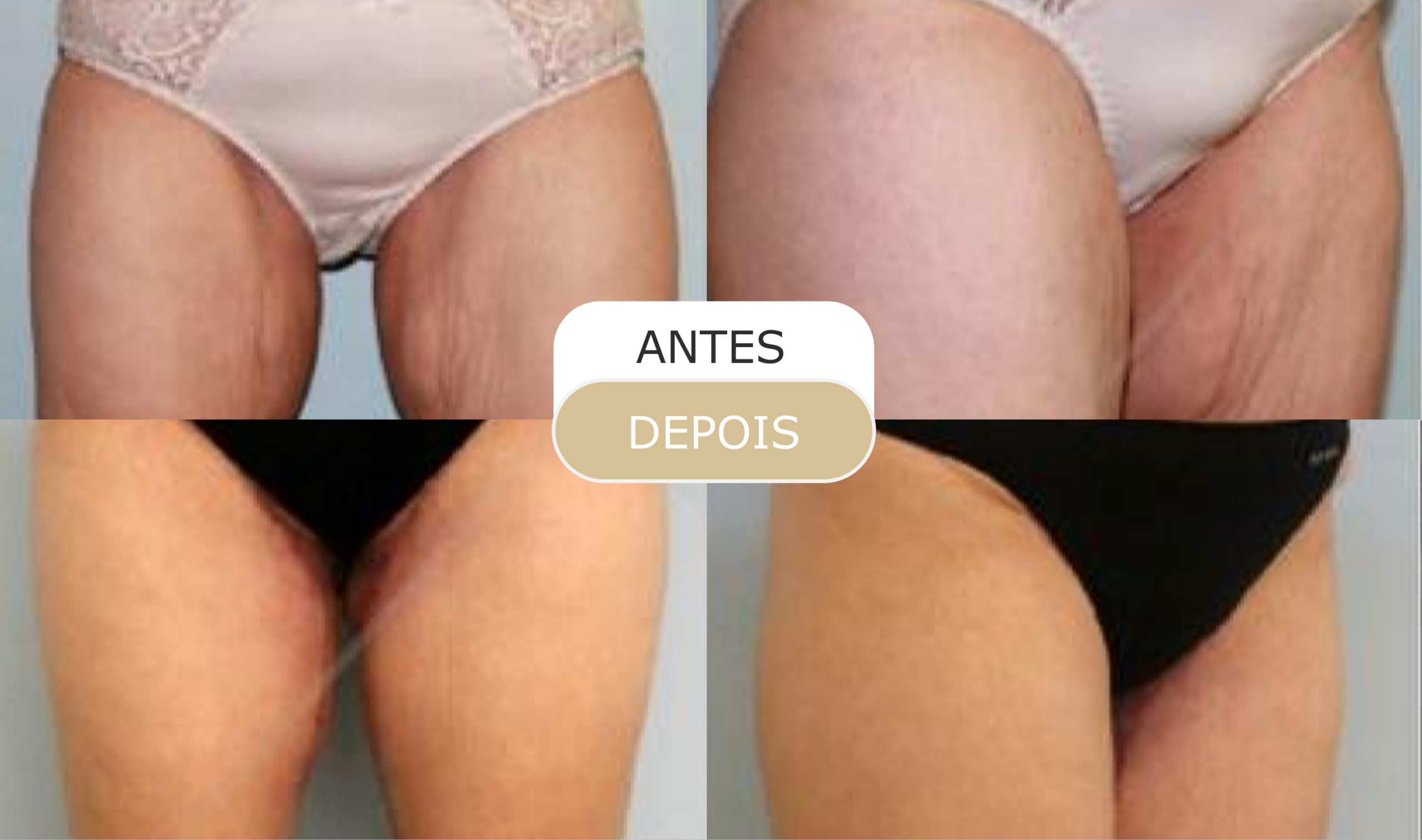 antes e depois - 25