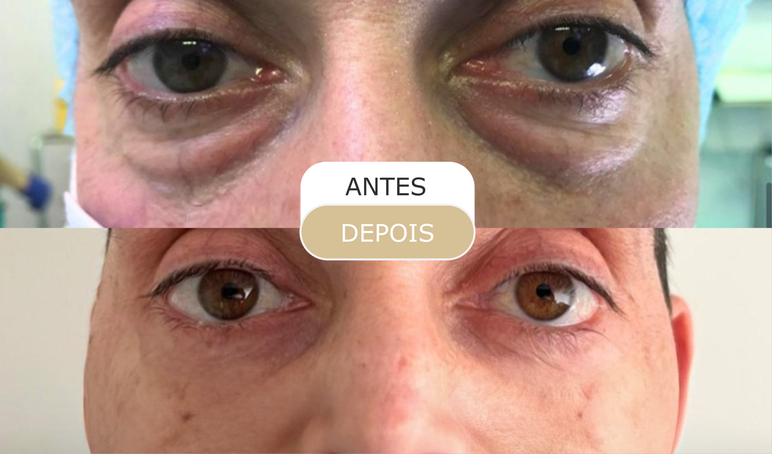 antes e depois - 26