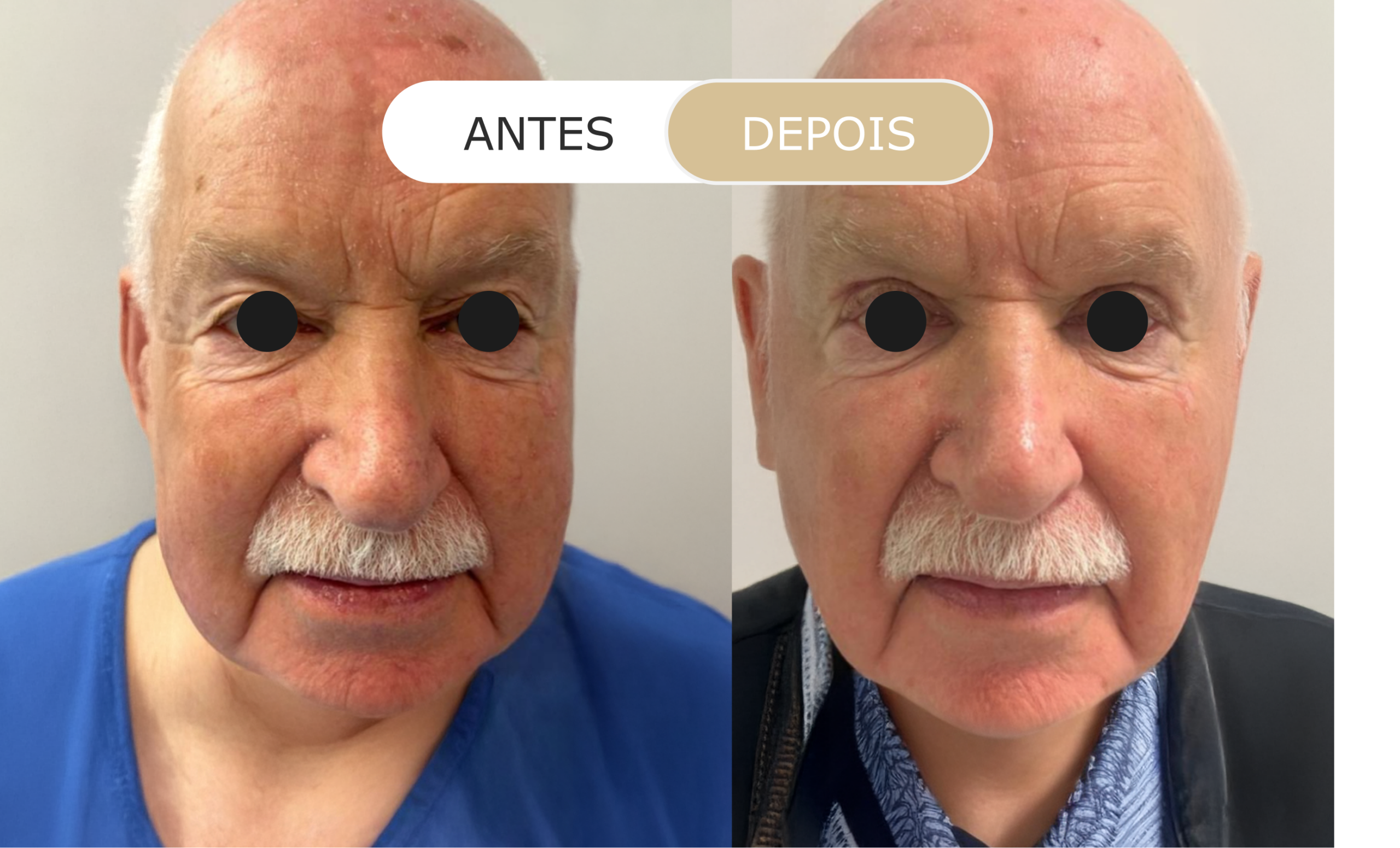 Home 29 antes e depois - 27