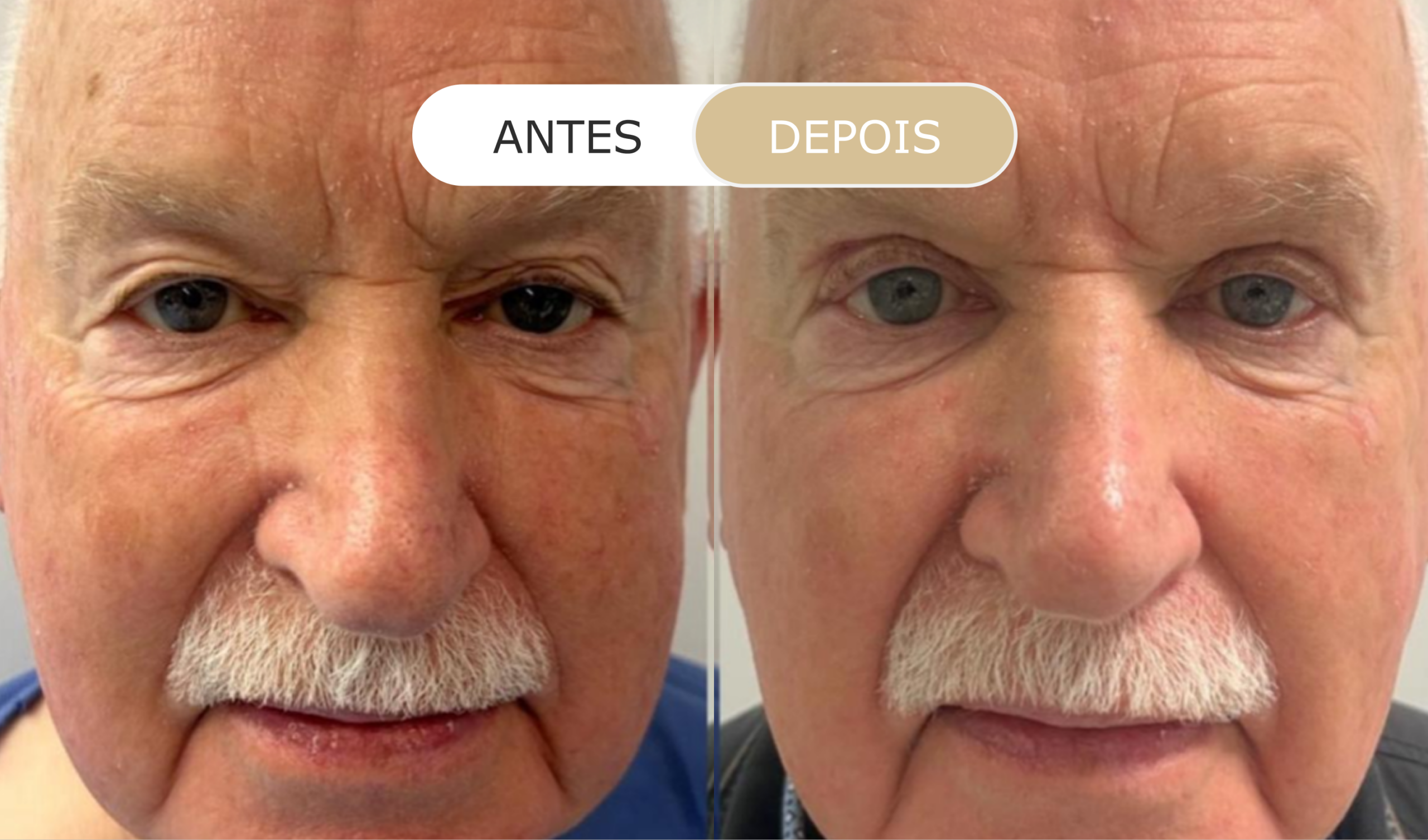 antes e depois - 27