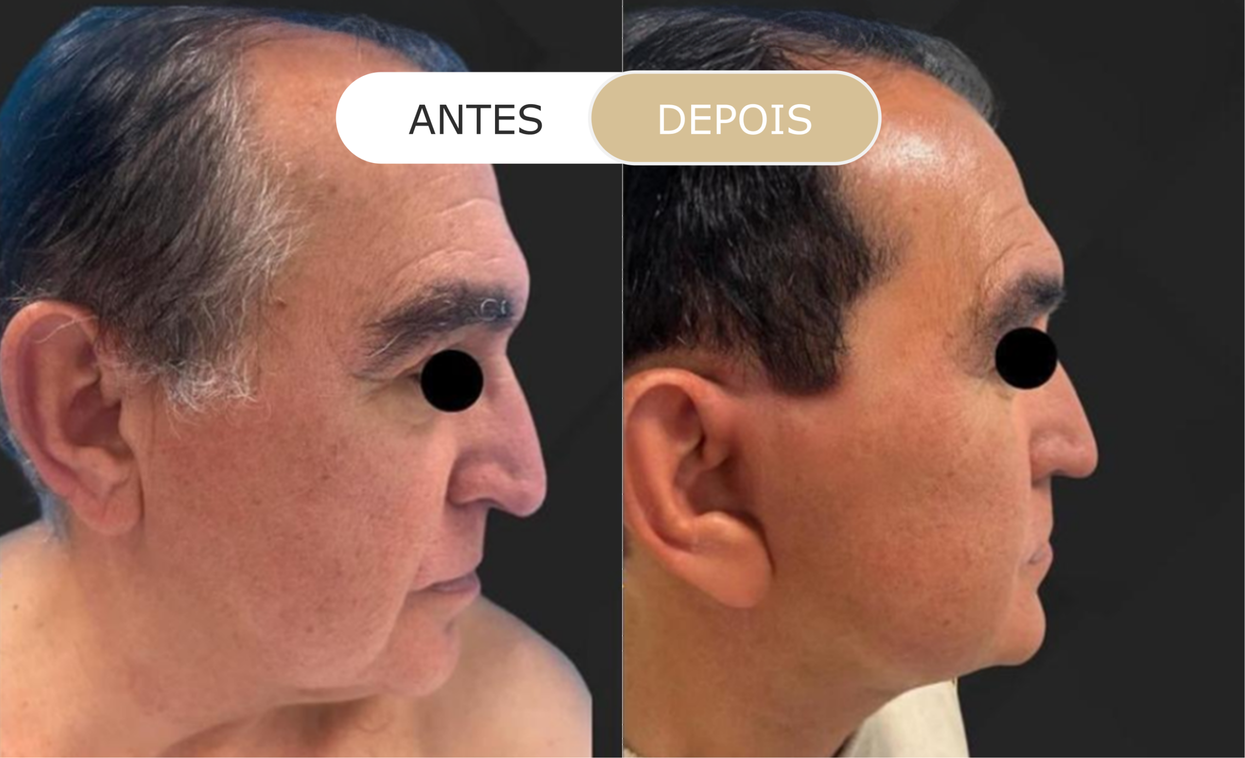 Home 16 antes e depois - 31