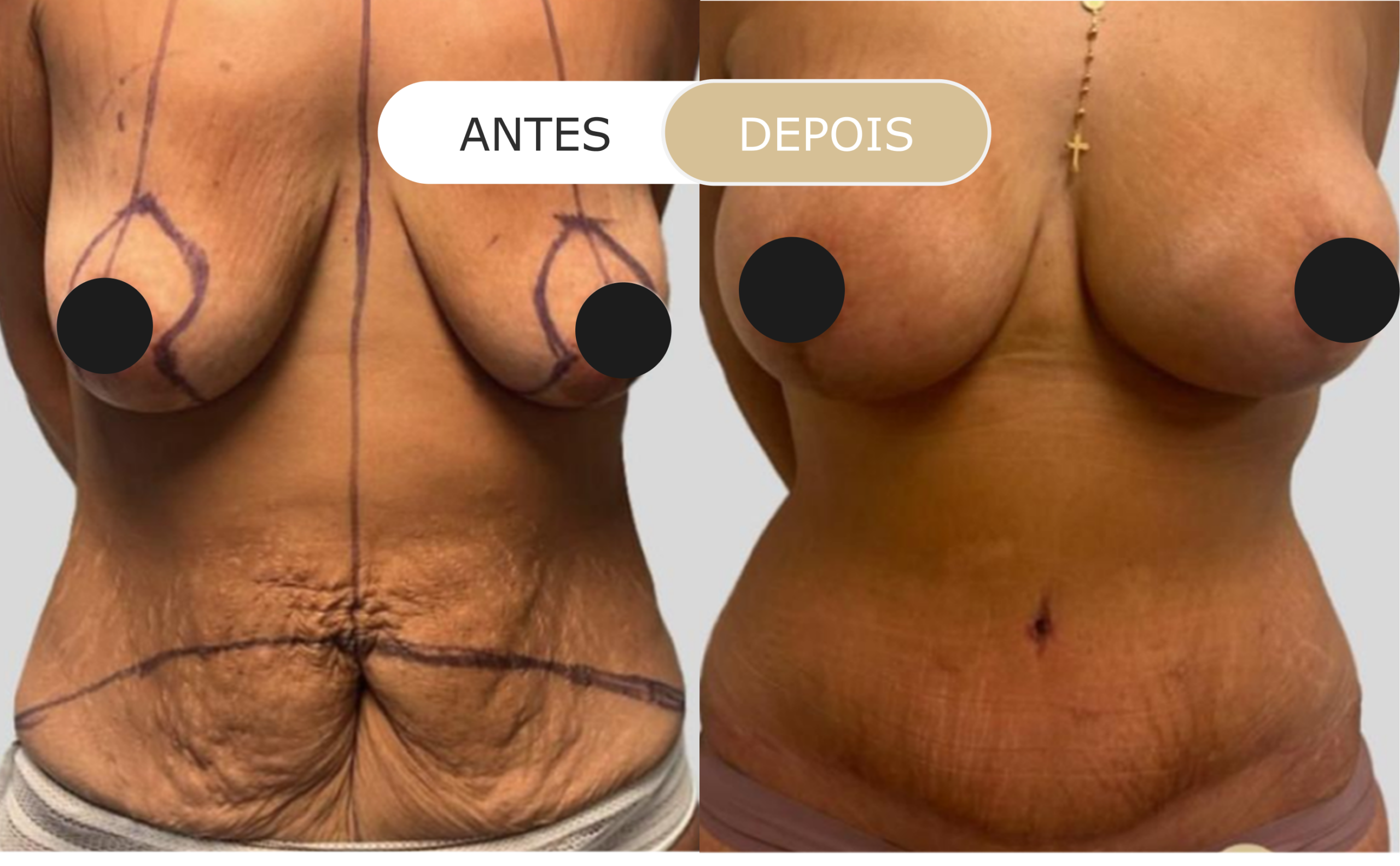 Home 39 antes e depois - 32