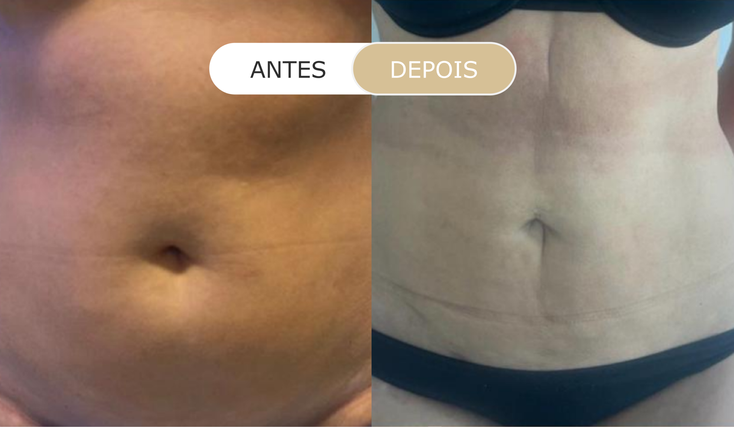 antes e depois - 7