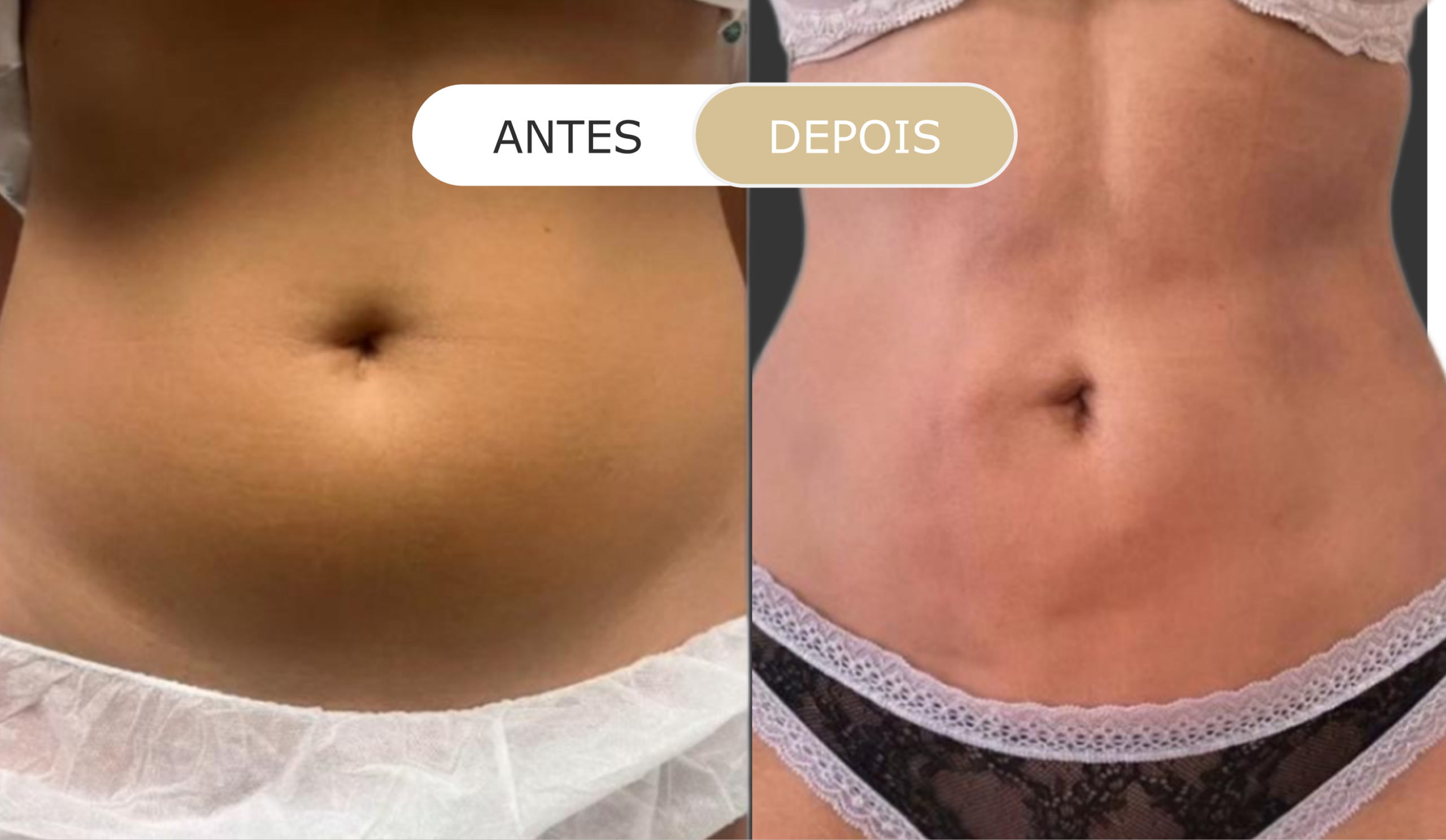 antes e depois - 8